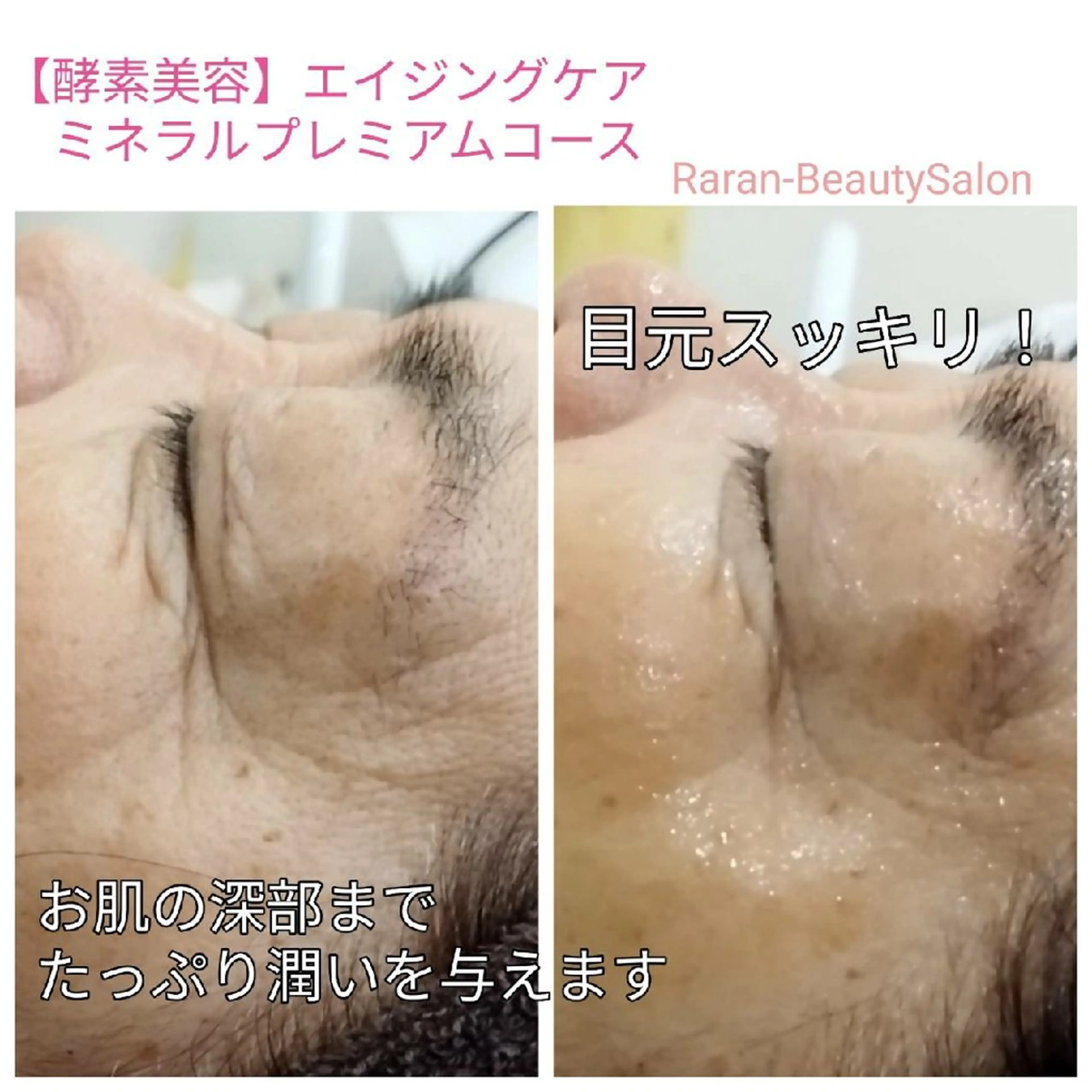 若返り 美肌   エステサロンららんのエステ・リラクイメージ