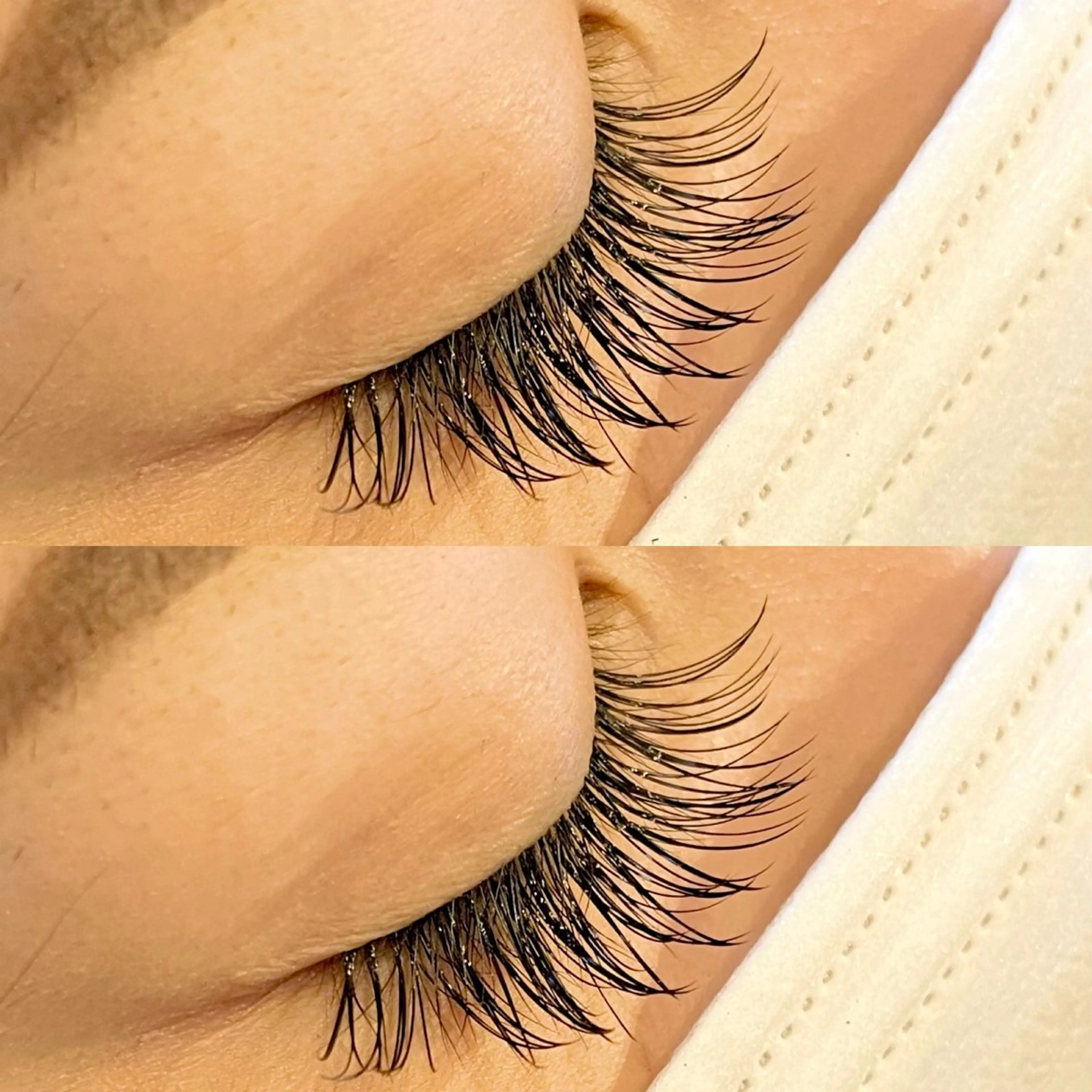 バインドロック【80束】💐の写真