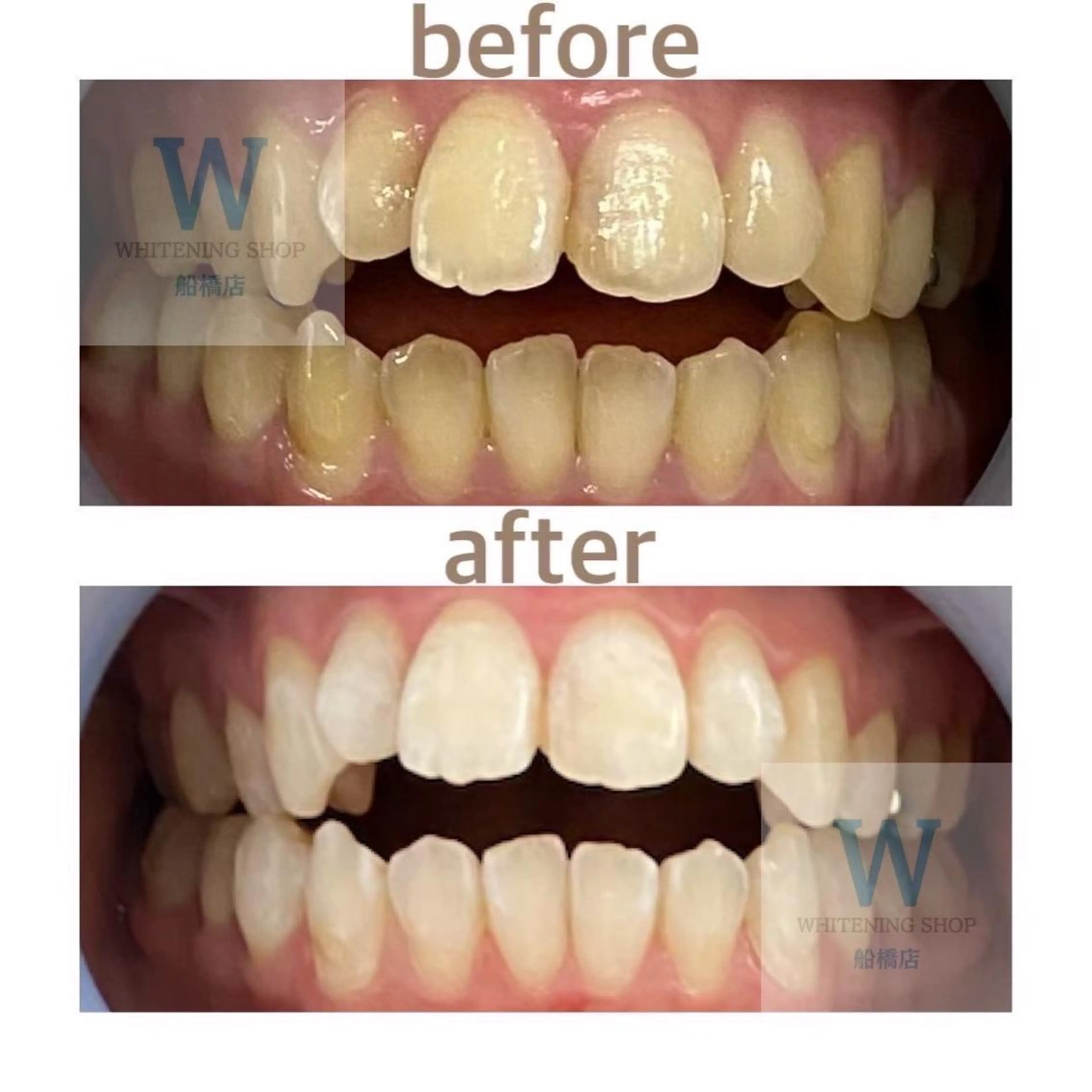 エステ リラク ホワイトニング ショップ船橋２号店のエステ・リラクイメージ