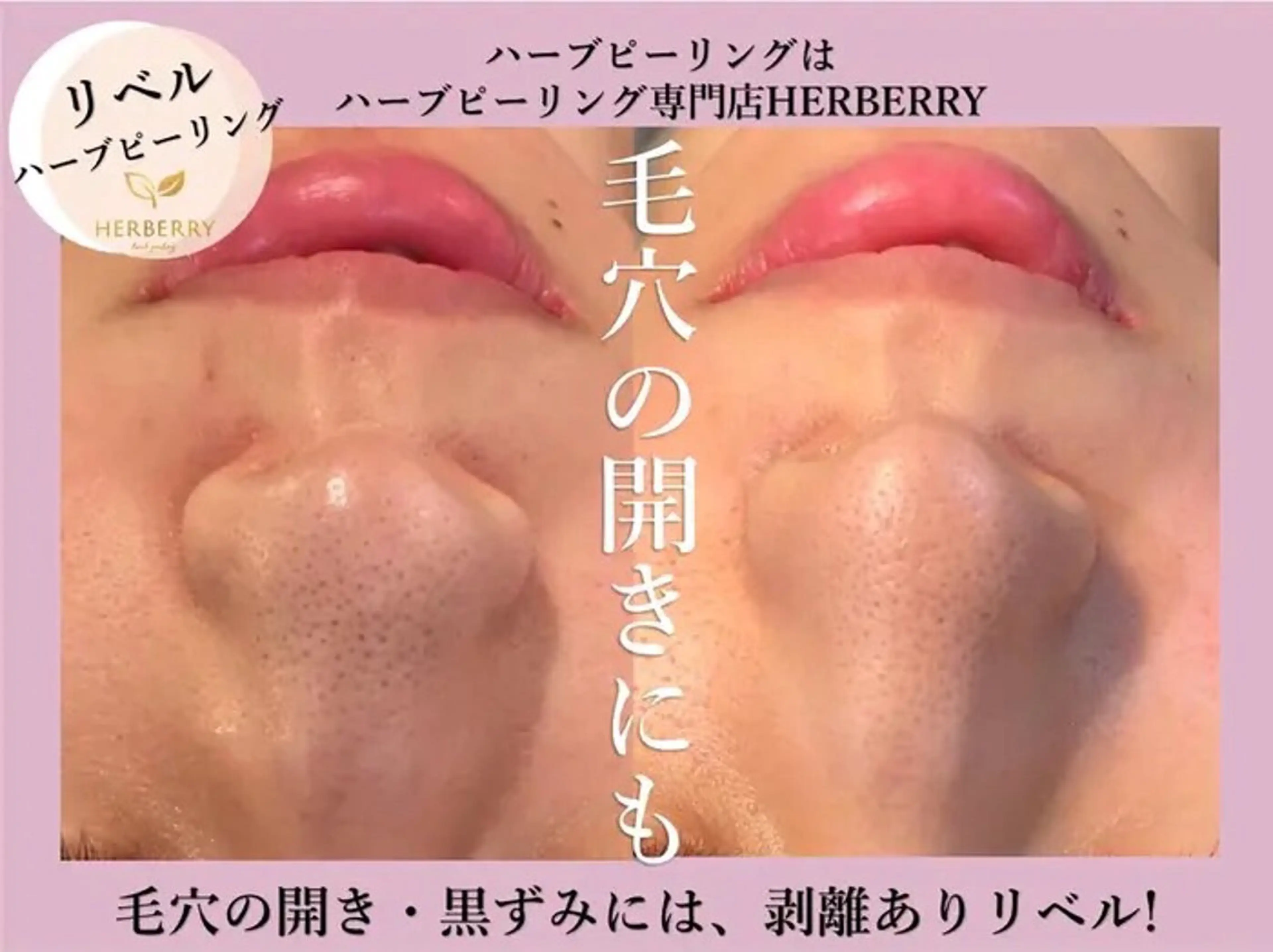 ハーブピーリング専門店HERBERRY難波心斎橋店所属・ハーブピーリング専門 HERBERRY冨永のエステ・リラクイメージ