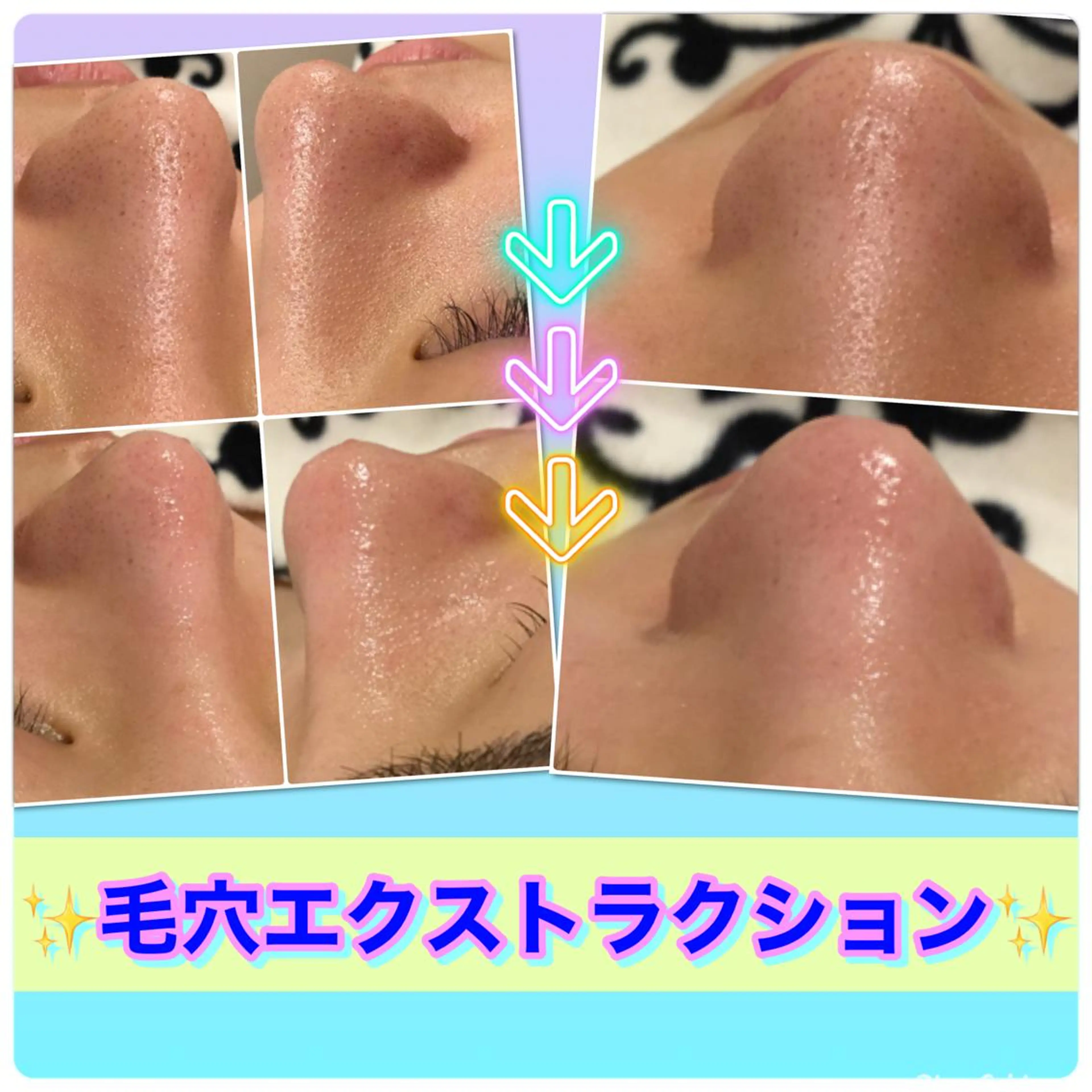 エステ 【リベルハーブピーリング認定店】敏感肌・美白脱毛専門店Dione立川店所属・Dione 立川店のエステ・リラクイメージ