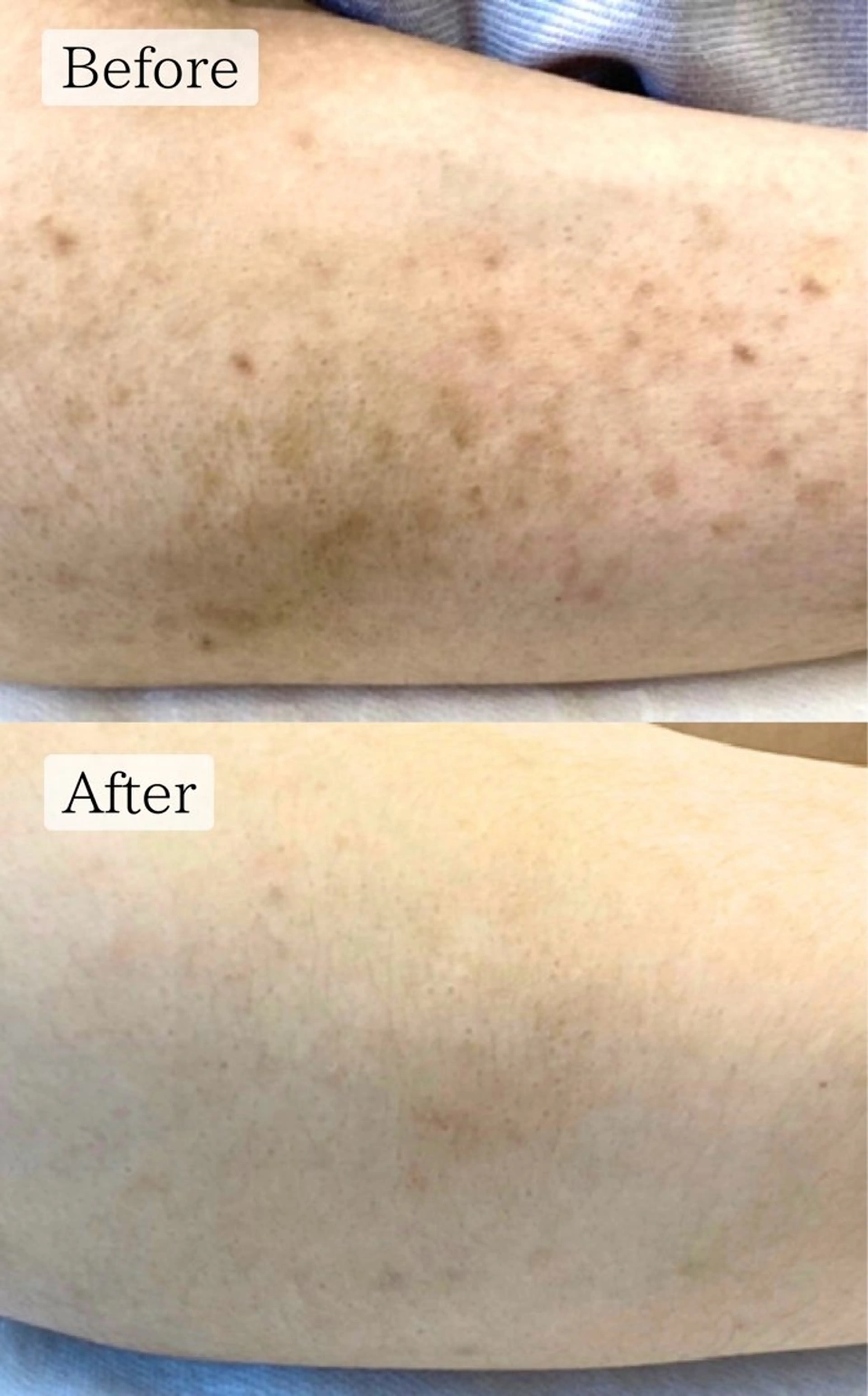 エステ 肌質改善専門サロン Bellmi/心斎橋のエステ・リラクイメージ