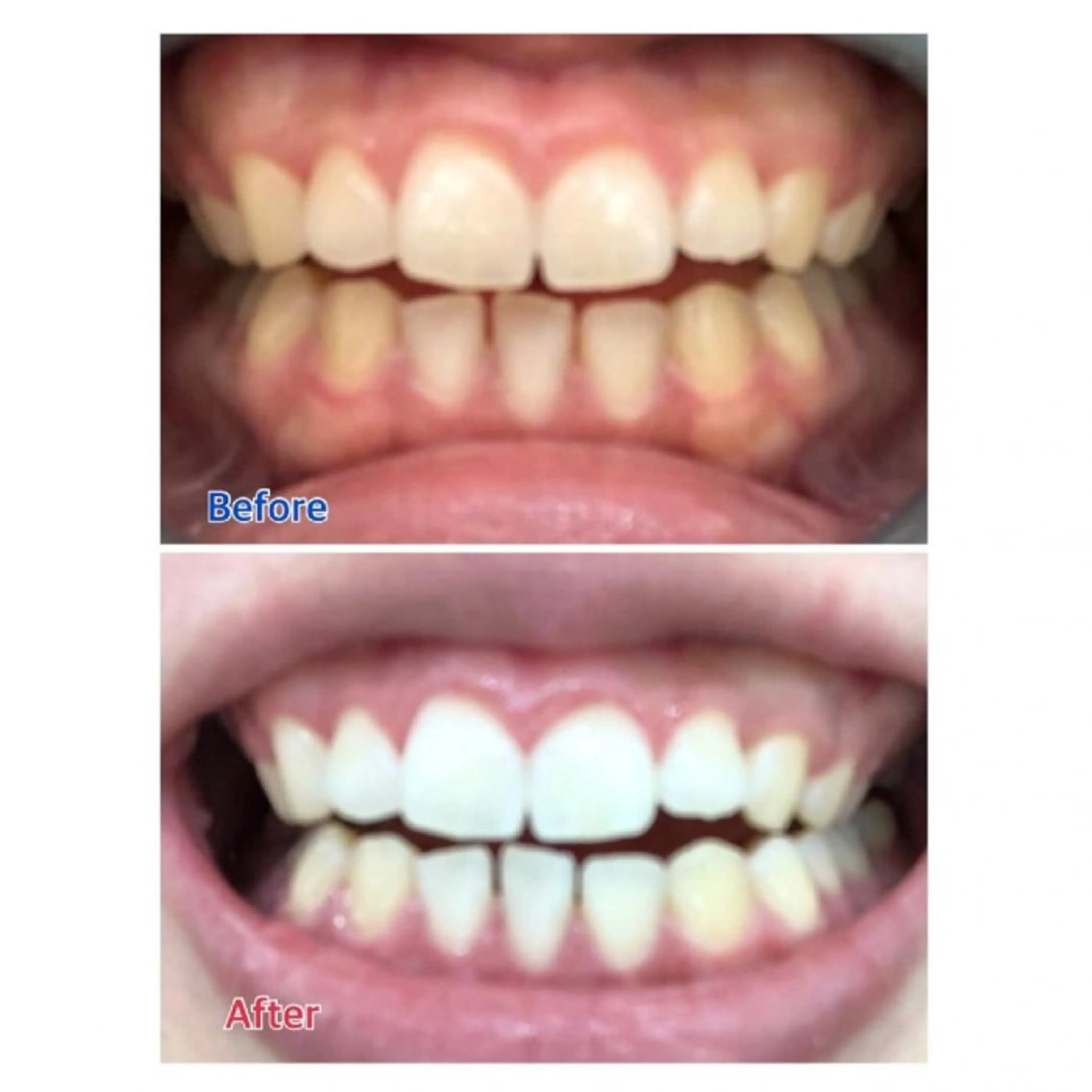 M渋谷店所属・Ｍ渋谷 ホワイトニングのその他イメージ