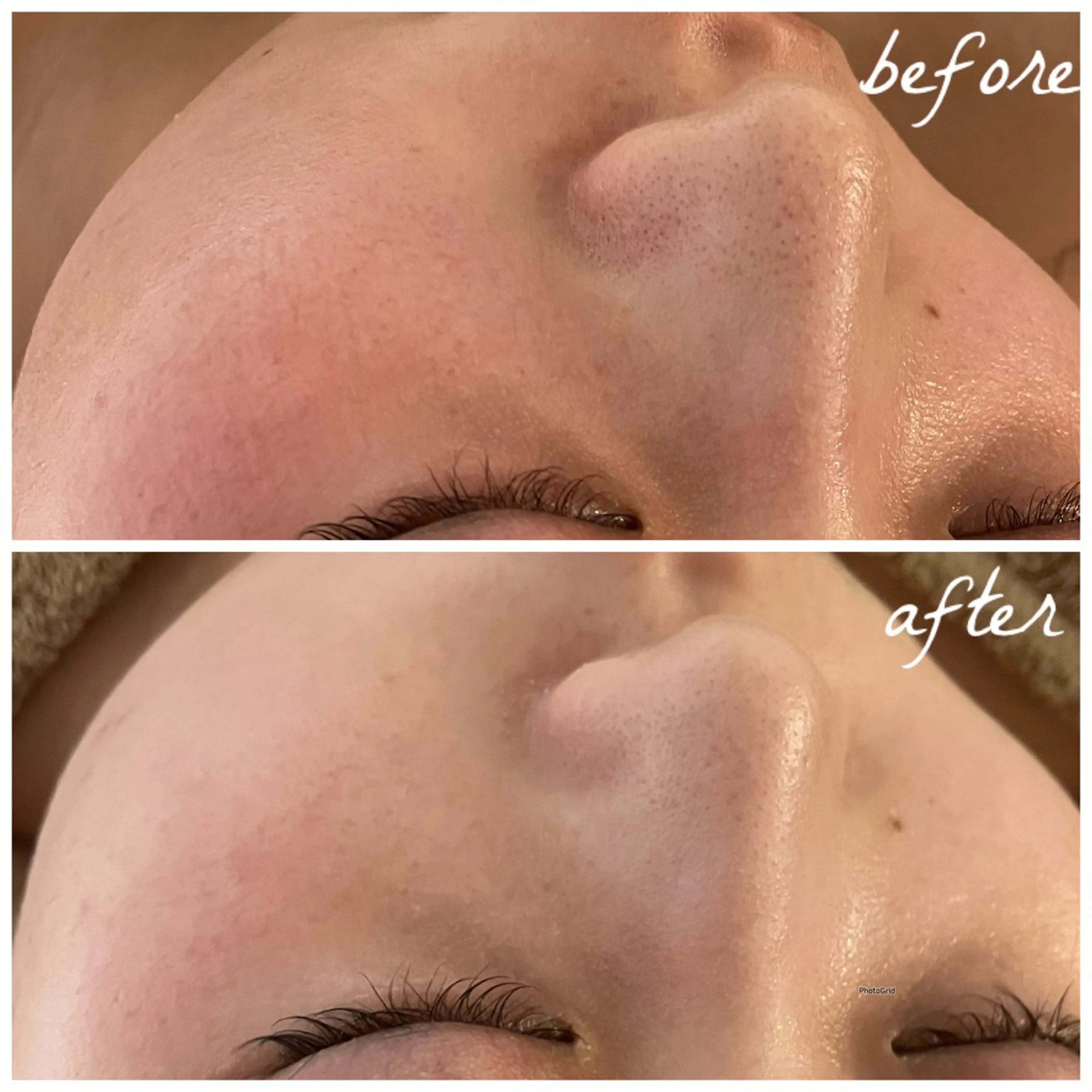 メンズ エステ メナード岐阜茜部 杉浦のエステ・リラクイメージ