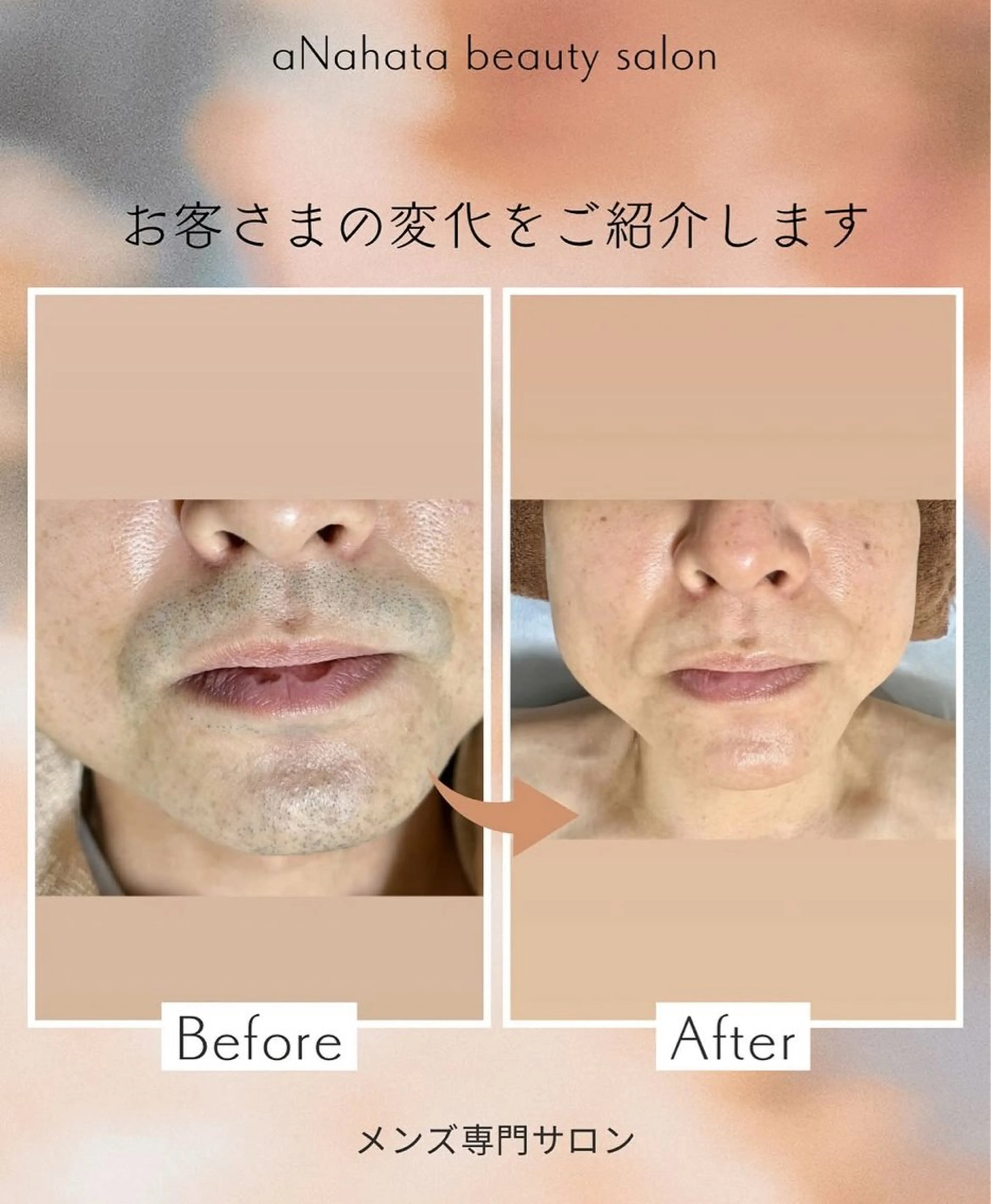 メンズ aNahata beauty salon所属・田中 菜月のエステ・リラクイメージ