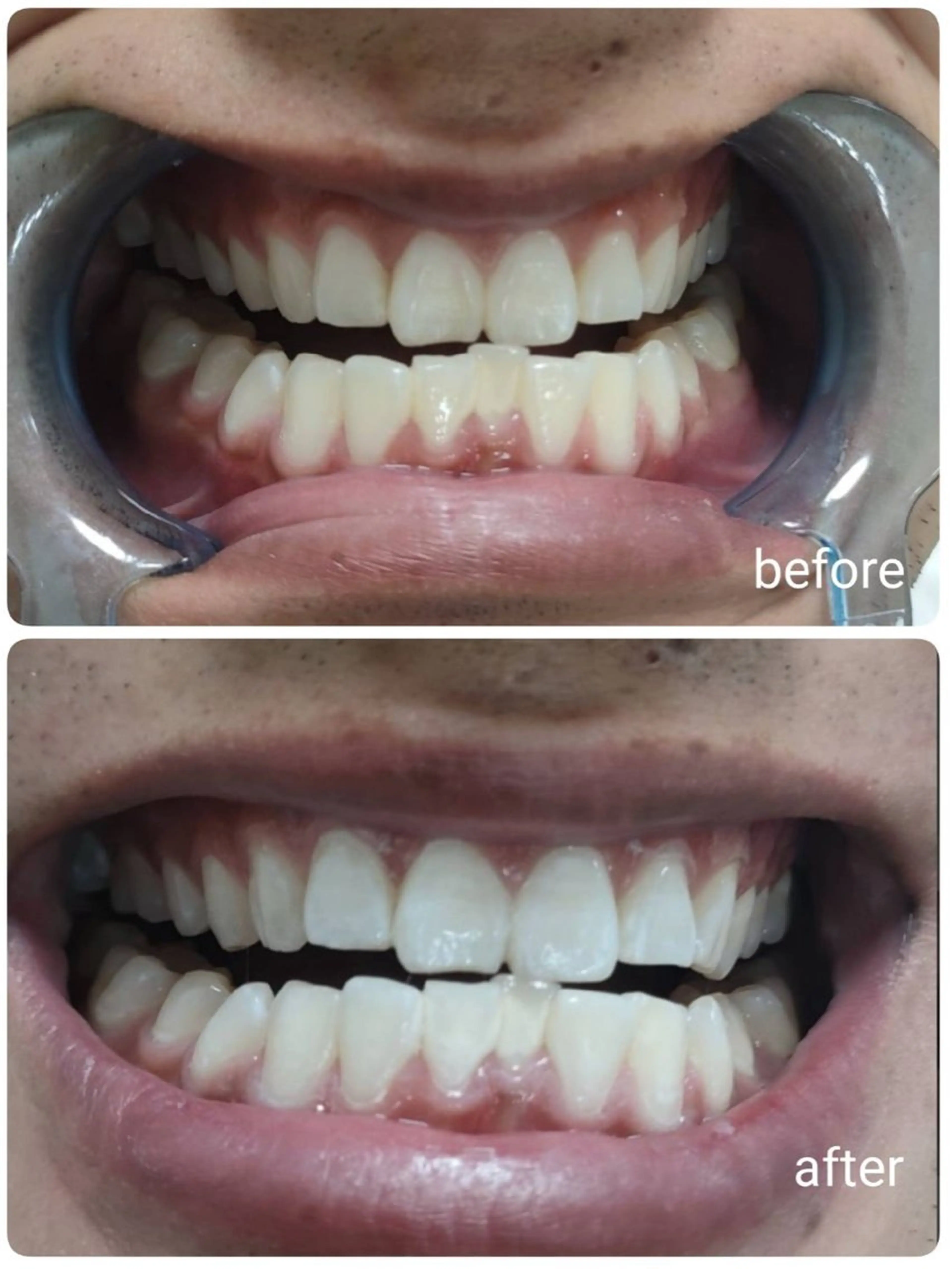 ecxia  white 　広島袋町店所属・セルフホワイトニング エクシア広島袋町店のその他イメージ