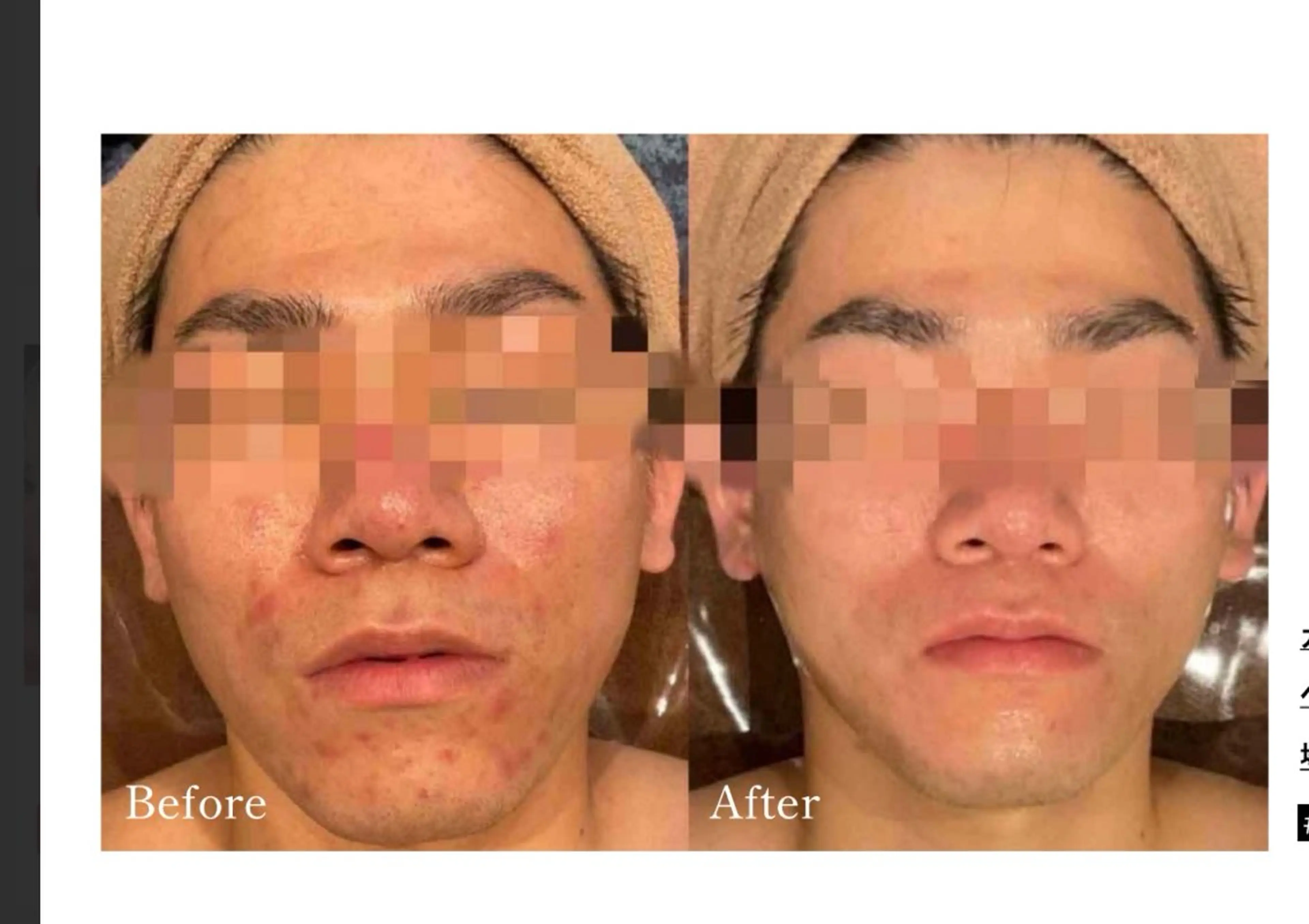 Total Beauty salon Bloom所属・肌育WISHpro 専門サロンBloomのエステ・リラクイメージ