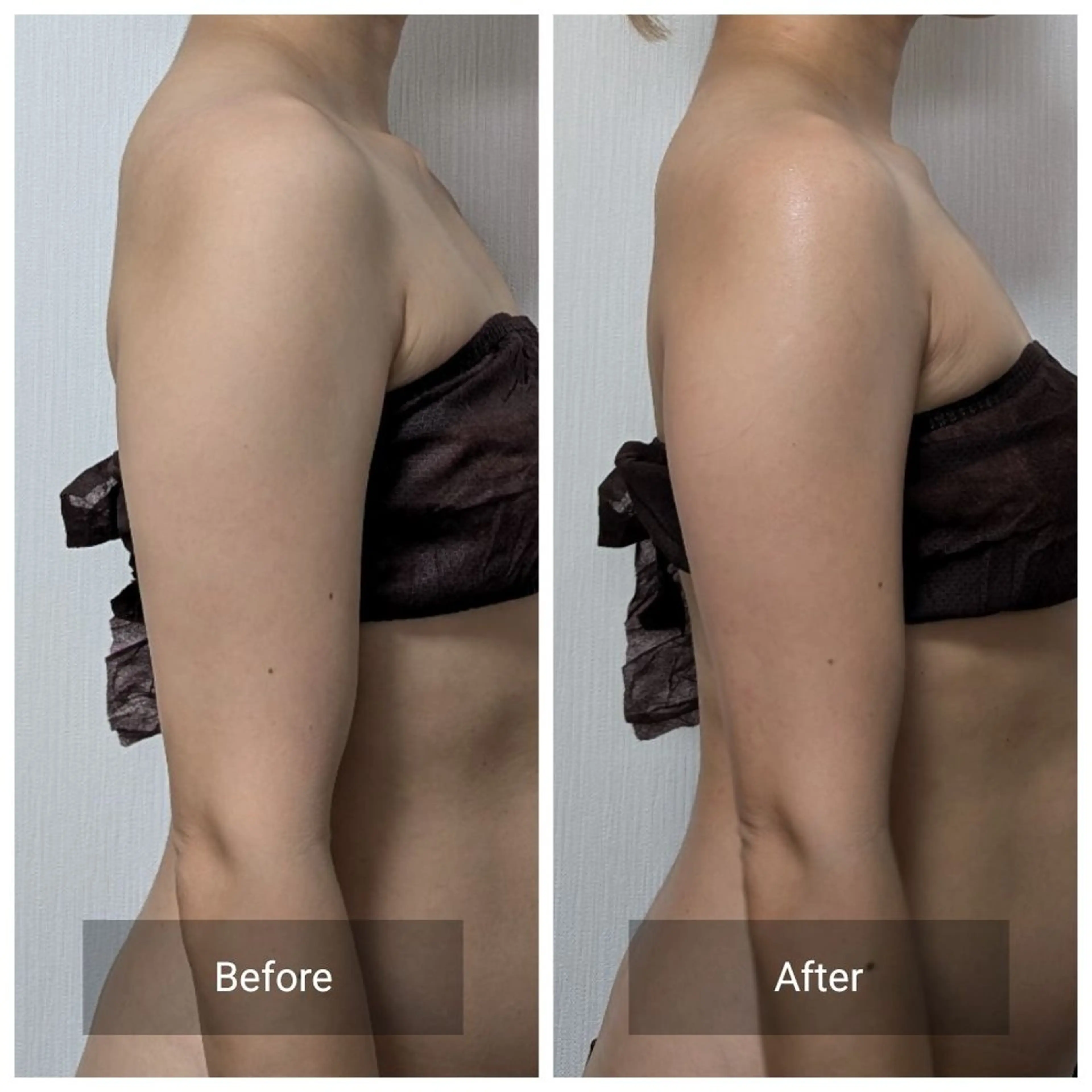 エステ nail RiRi アトレナチュラのエステ・リラクイメージ