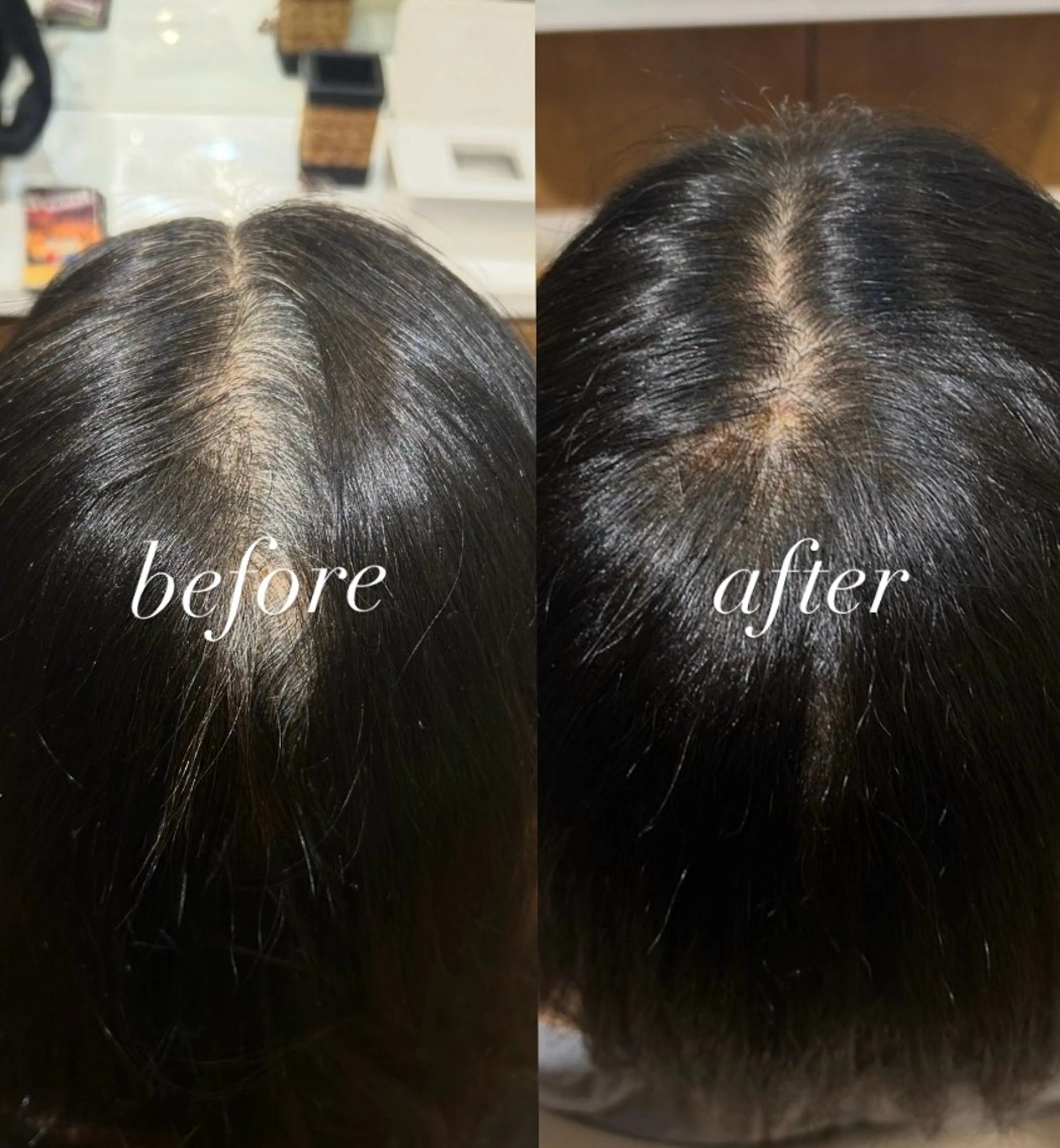 カラー ヘアカラー 根本 琴子のヘアスタイル