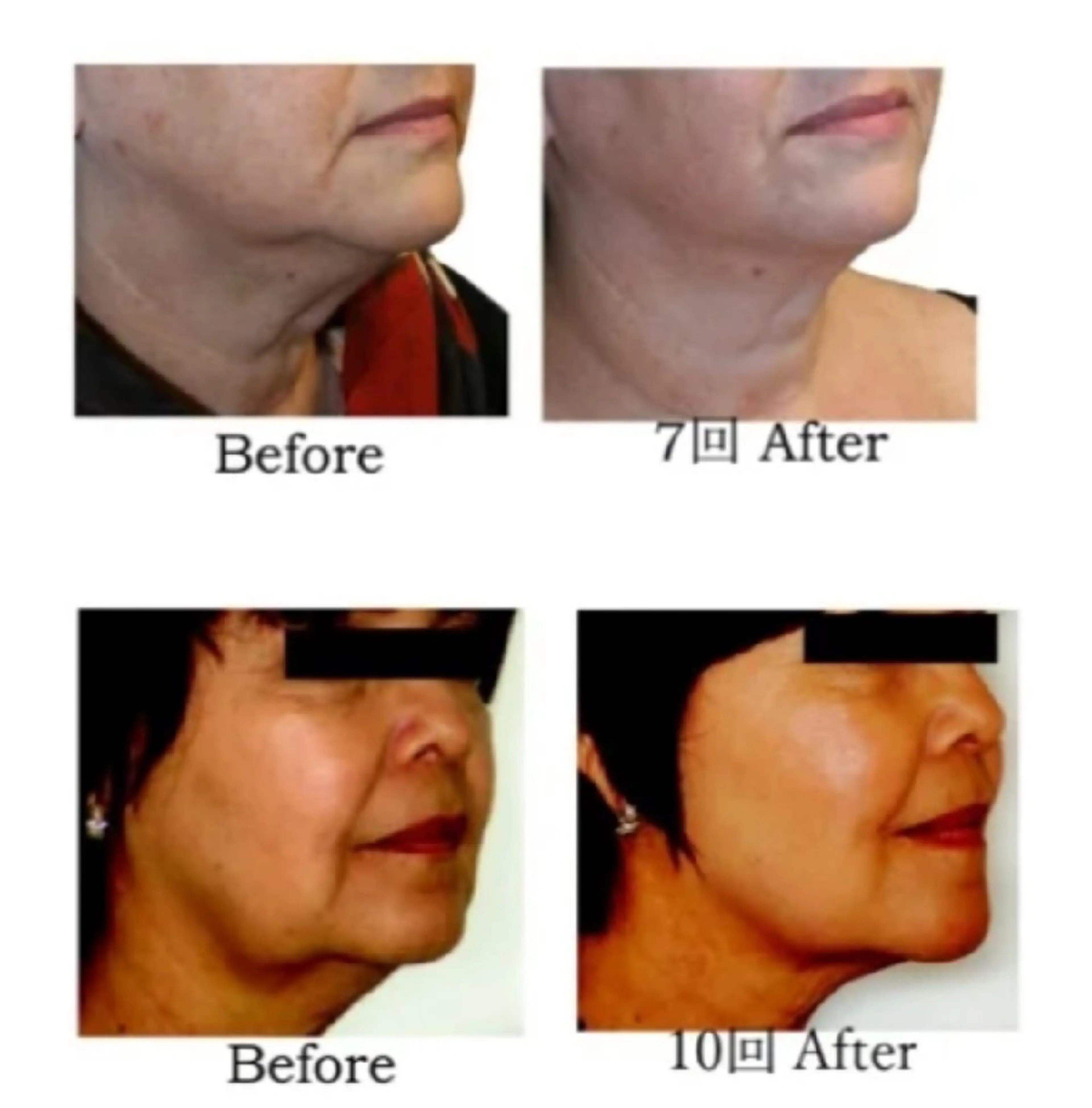 美肌/小顔専門店 peony.のエステ・リラクイメージ