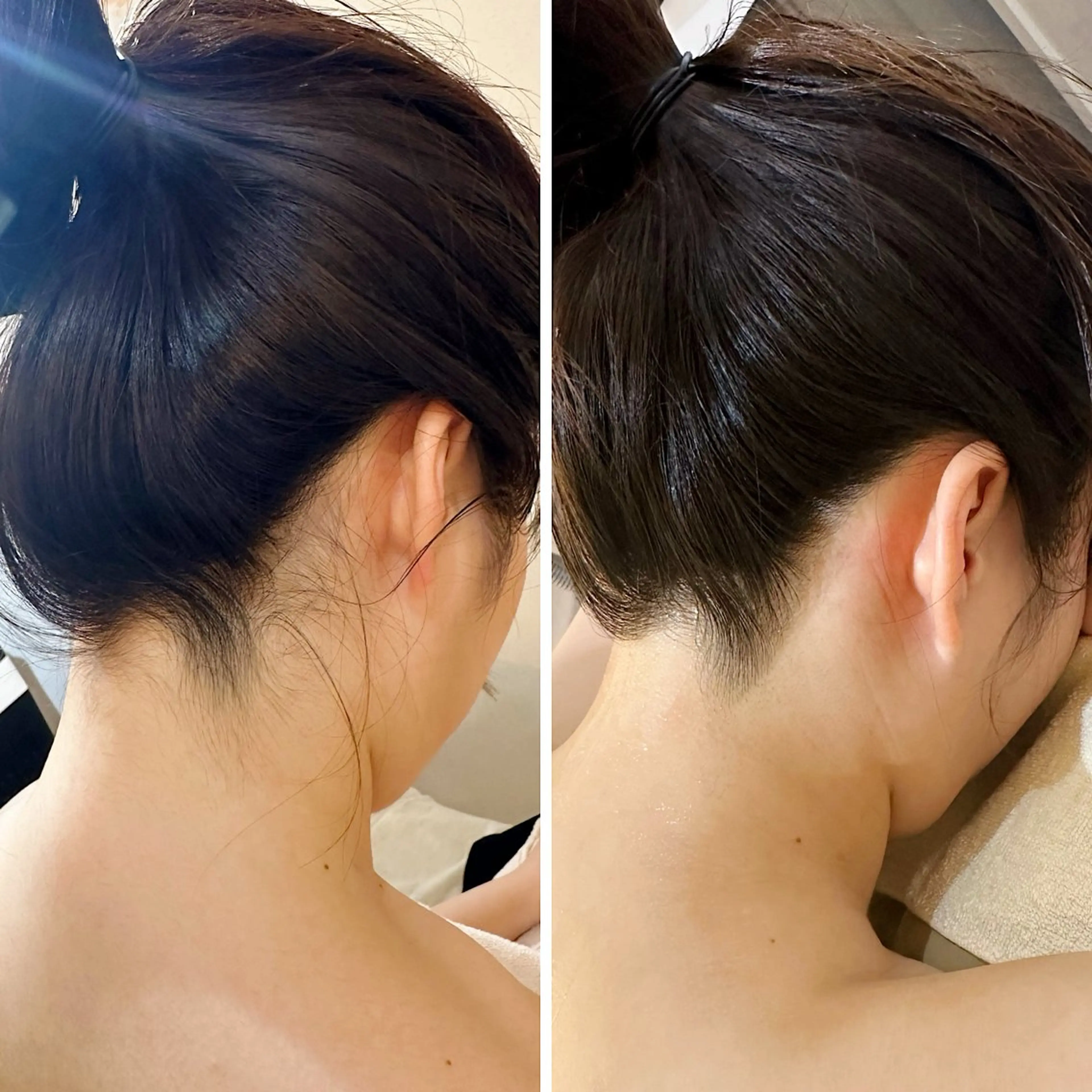 脱毛 うなじ脱毛/美肌脱毛 LABELのエステ・リラクイメージ