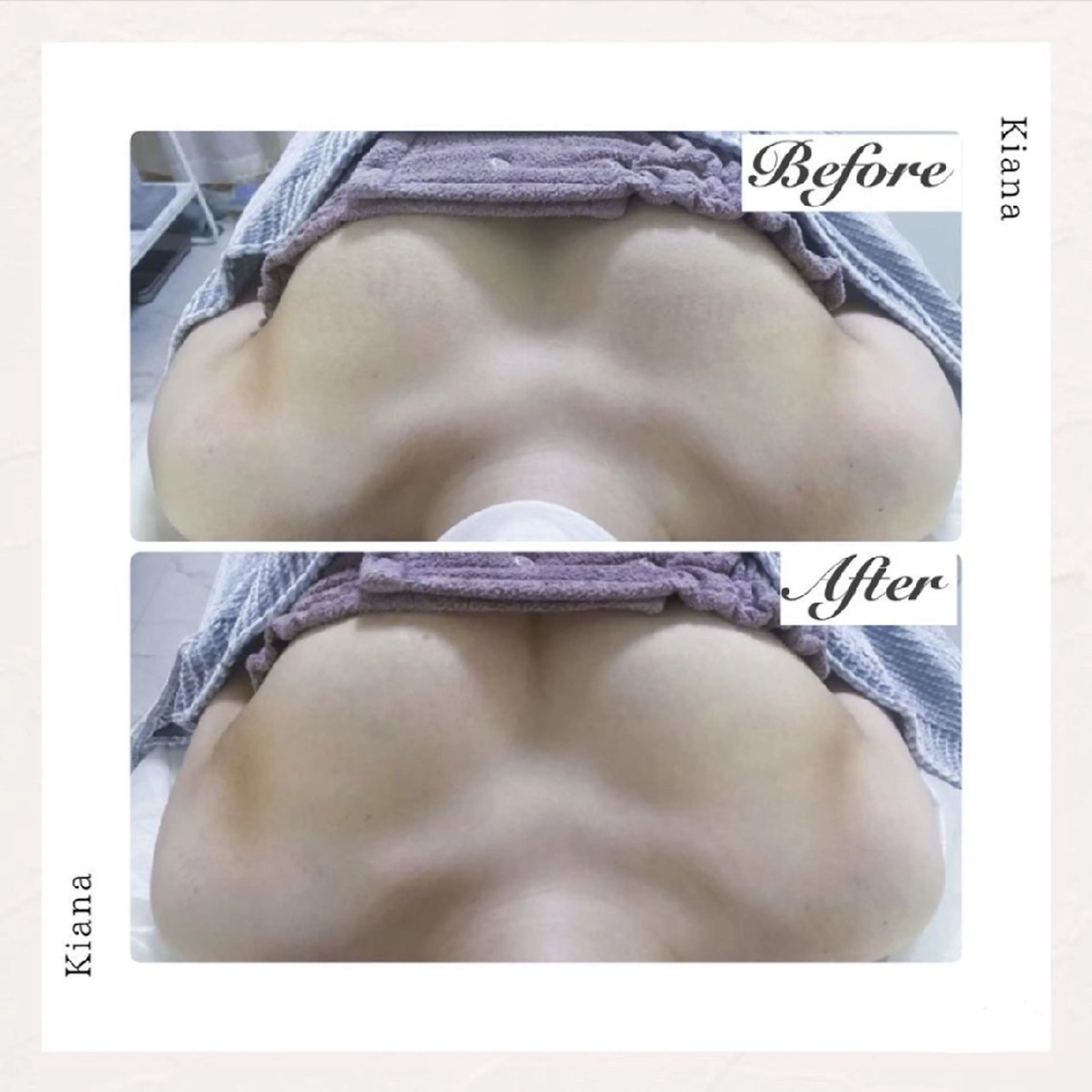 【バスト専門店 】 Kiana のエステ・リラクイメージ