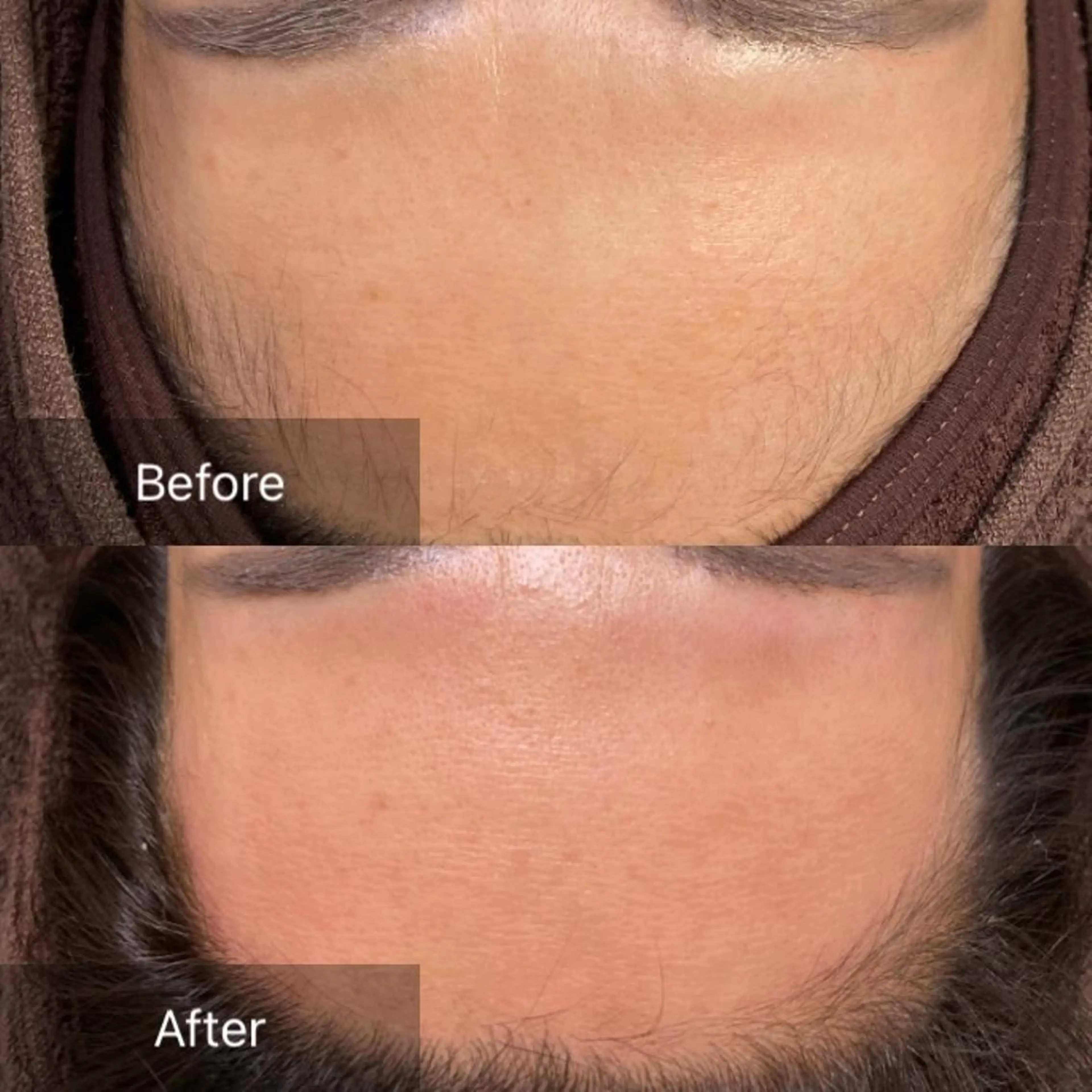 脱毛 産毛専門店 Bittoのエステ・リラクイメージ