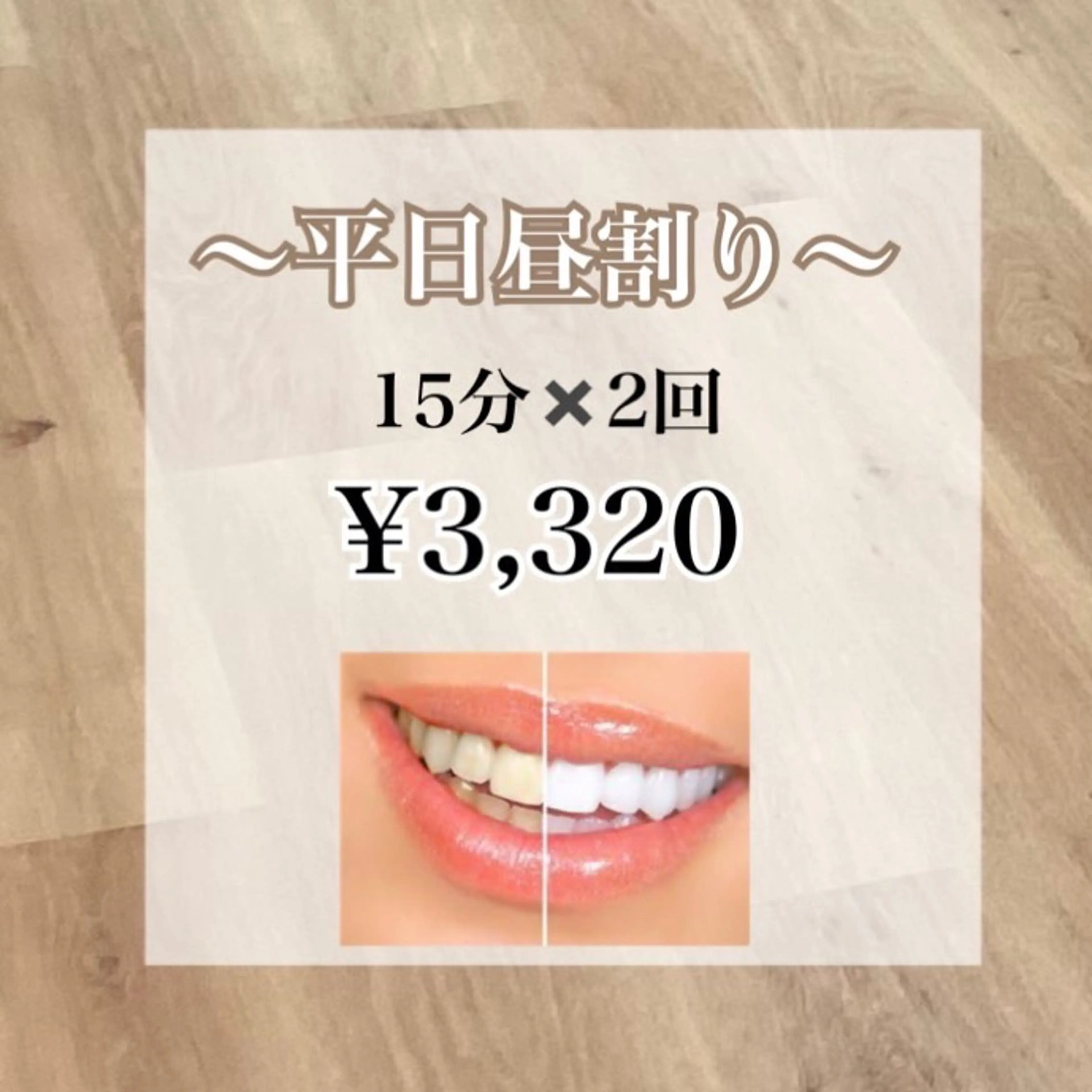 平日昼割  セルフホワイトニング 15分×2回の写真