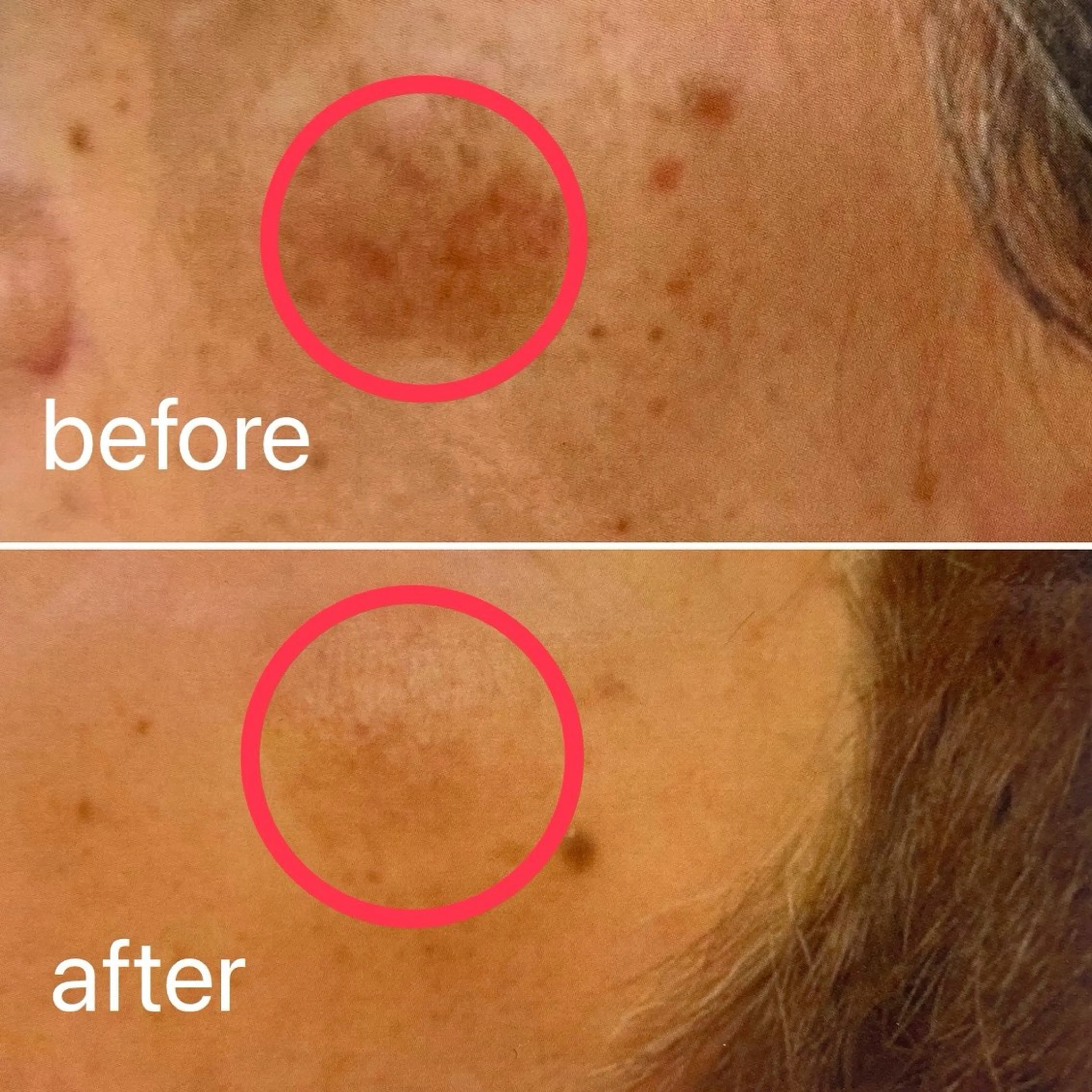 痛くないシミ取り 【荻窪】石橋のヘアスタイル