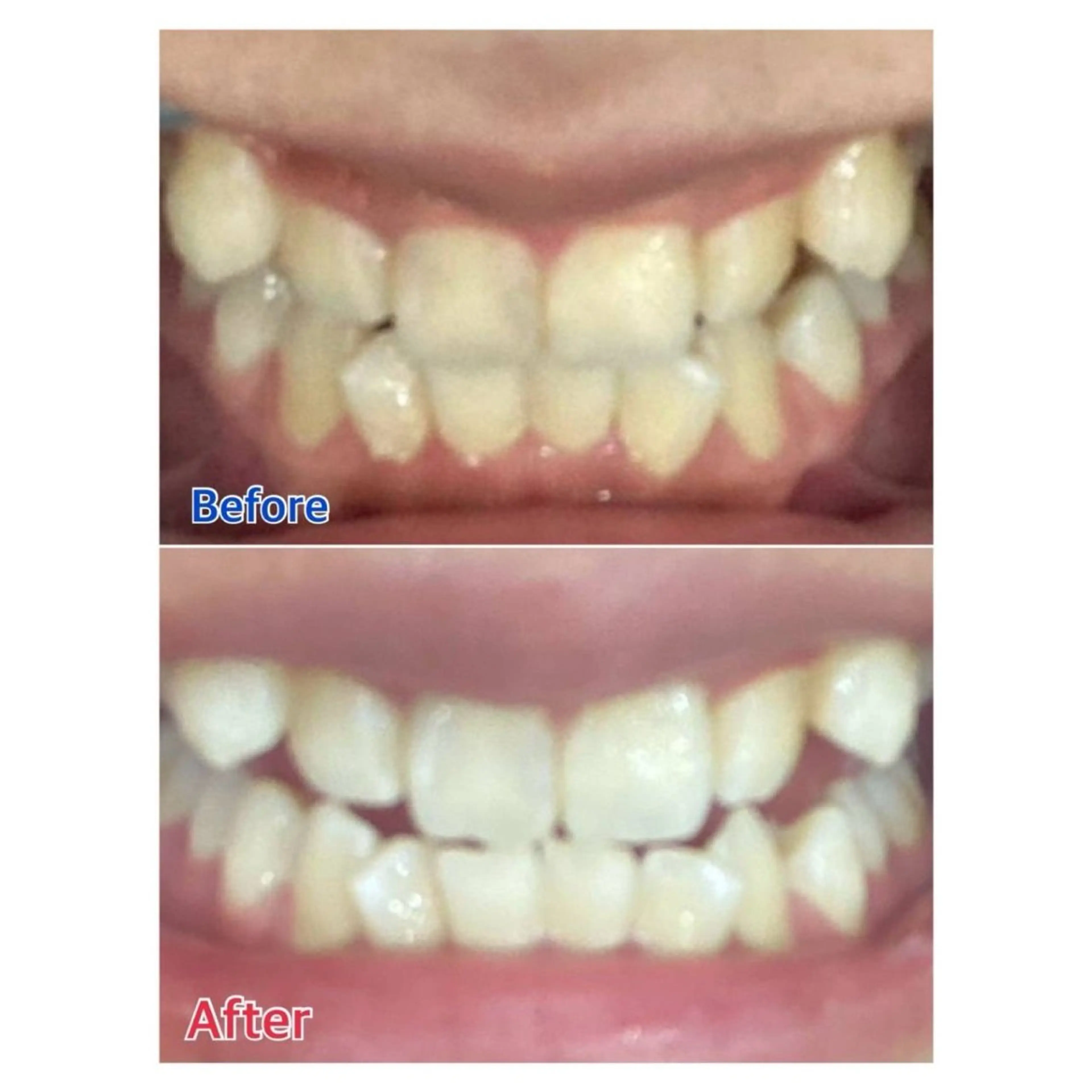 MBEAUTYSALON 千葉店・京成大久保所属・Melty 輝のその他イメージ