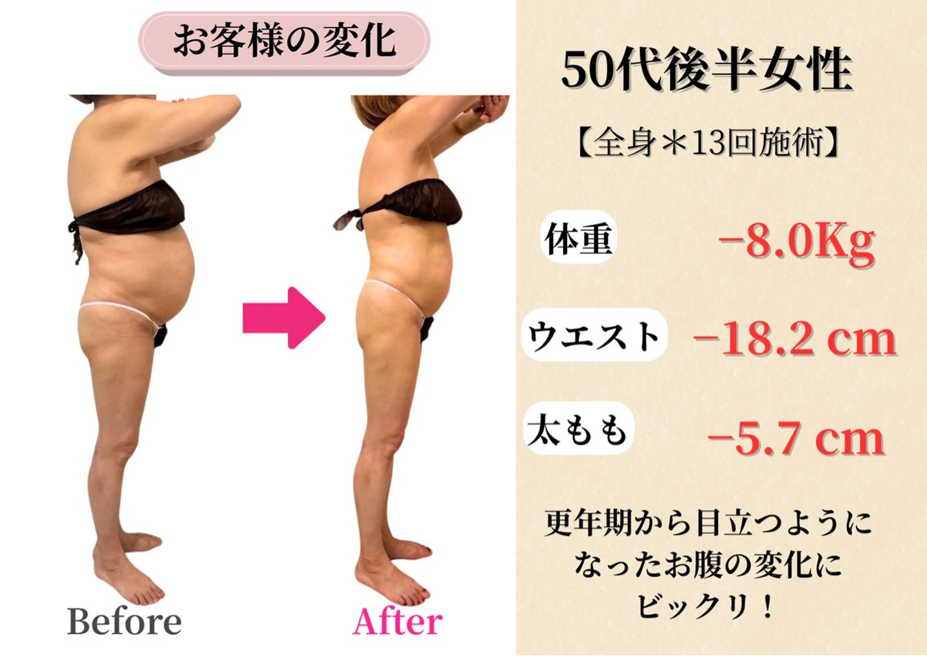 エステ Belle White所属・本格痩身＊肌質改善＊ BelleWhiteのエステ・リラクイメージ