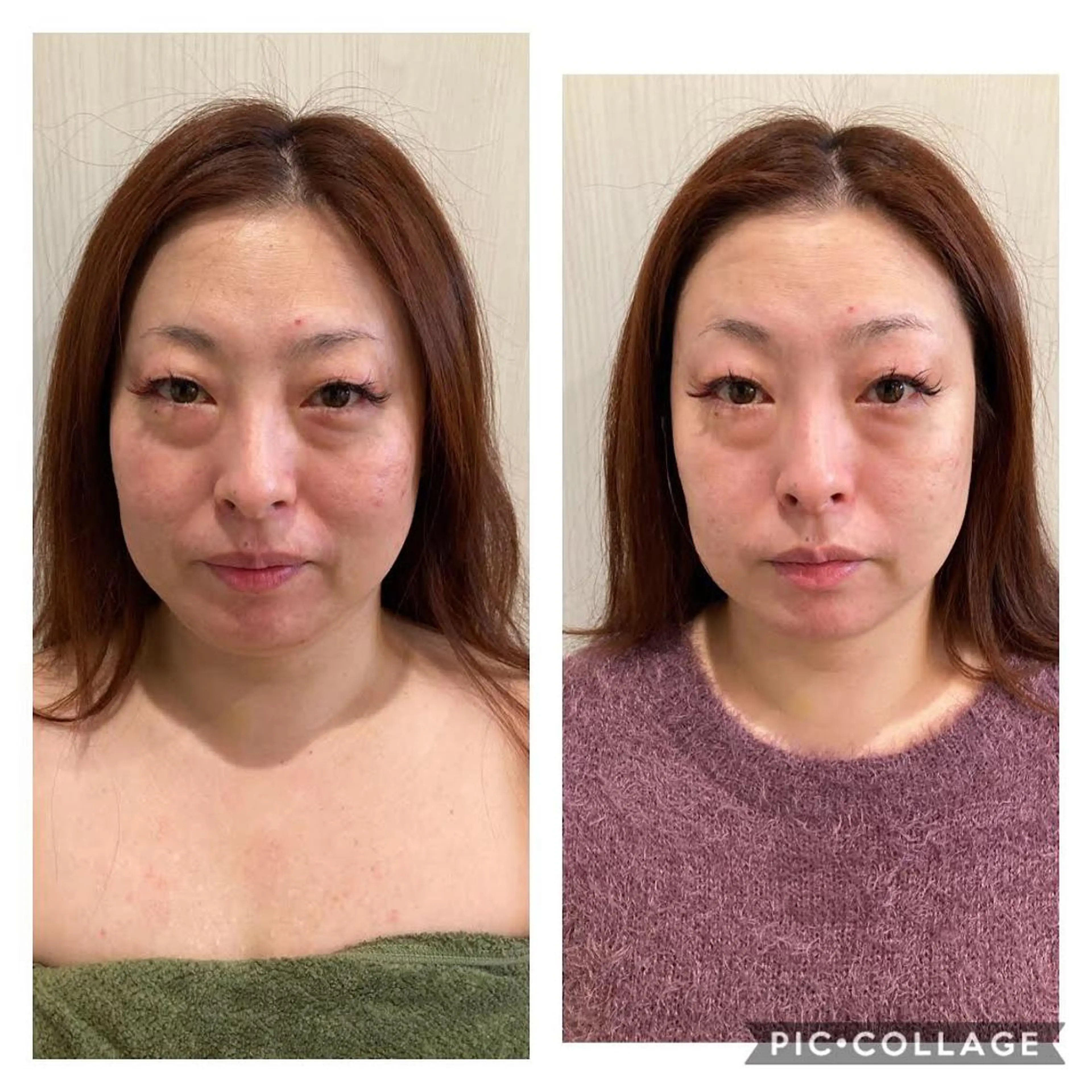 ナウフィールド 今野のエステ・リラクイメージ