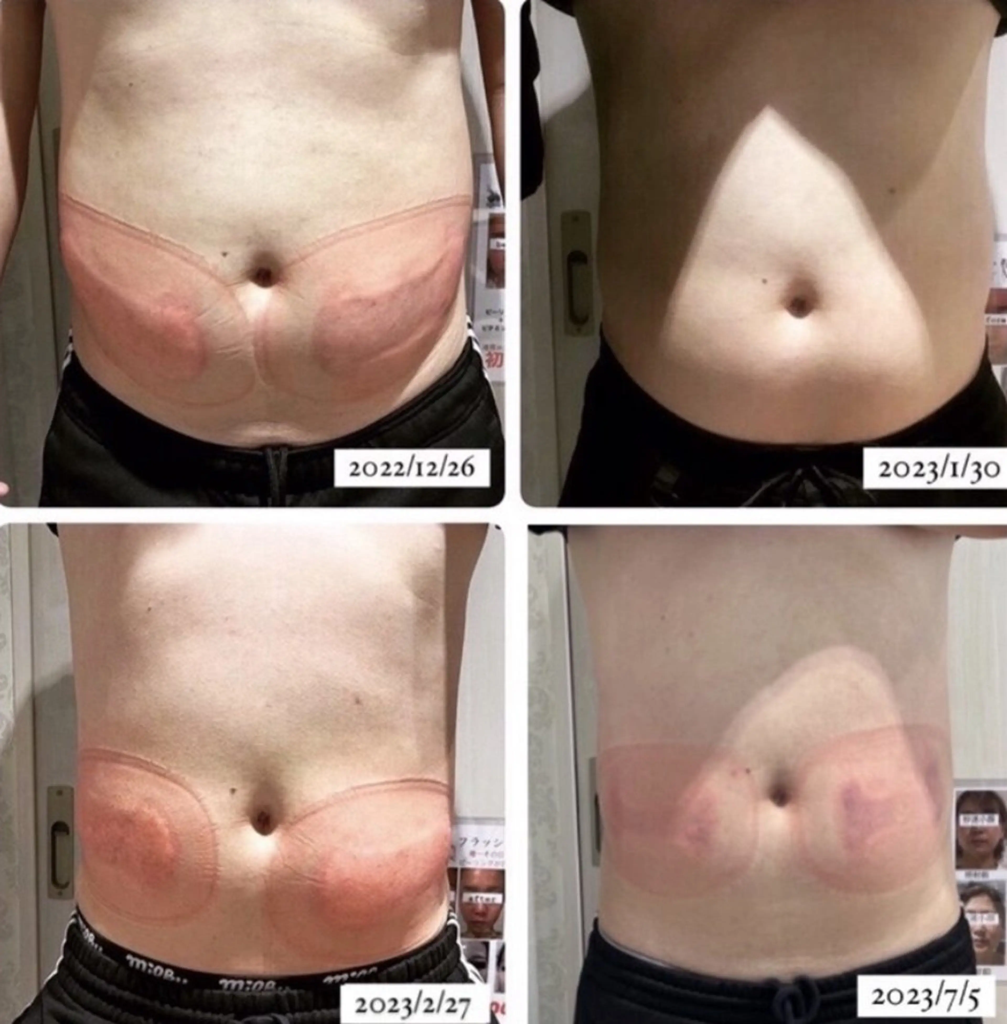 秒速小顔新宿南口 大谷のその他イメージ
