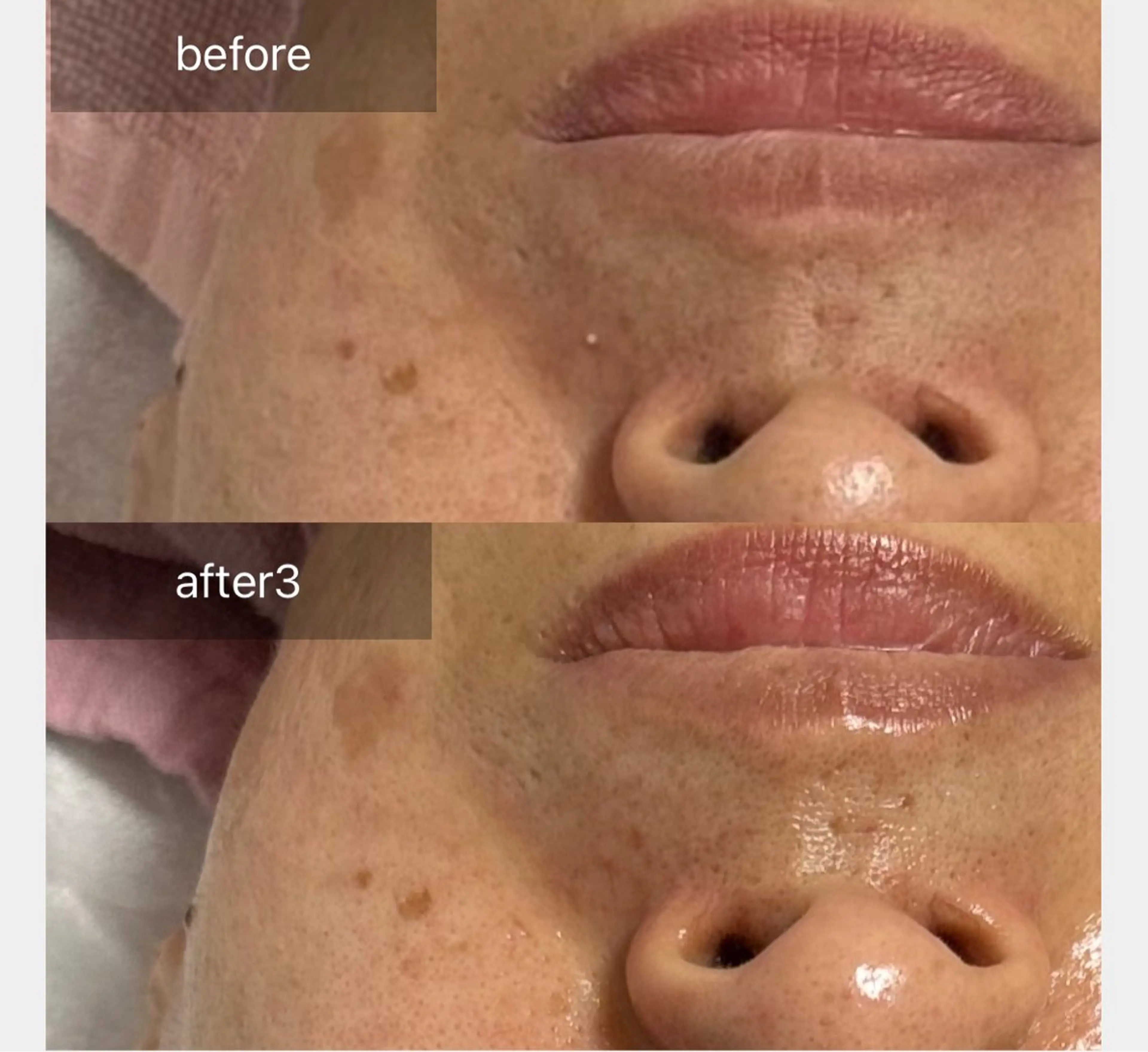 ALIA Scintiller  アリアサンティエ所属・齋藤 祐里耶のエステ・リラクイメージ