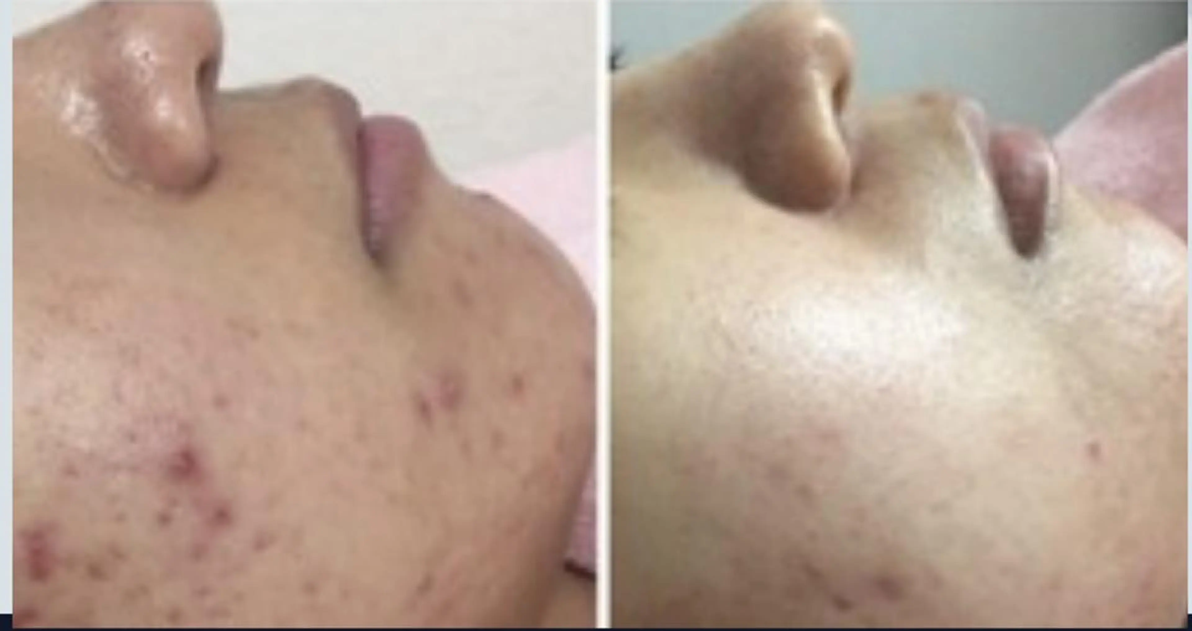 アトリエ ハルミナのネイルデザイン