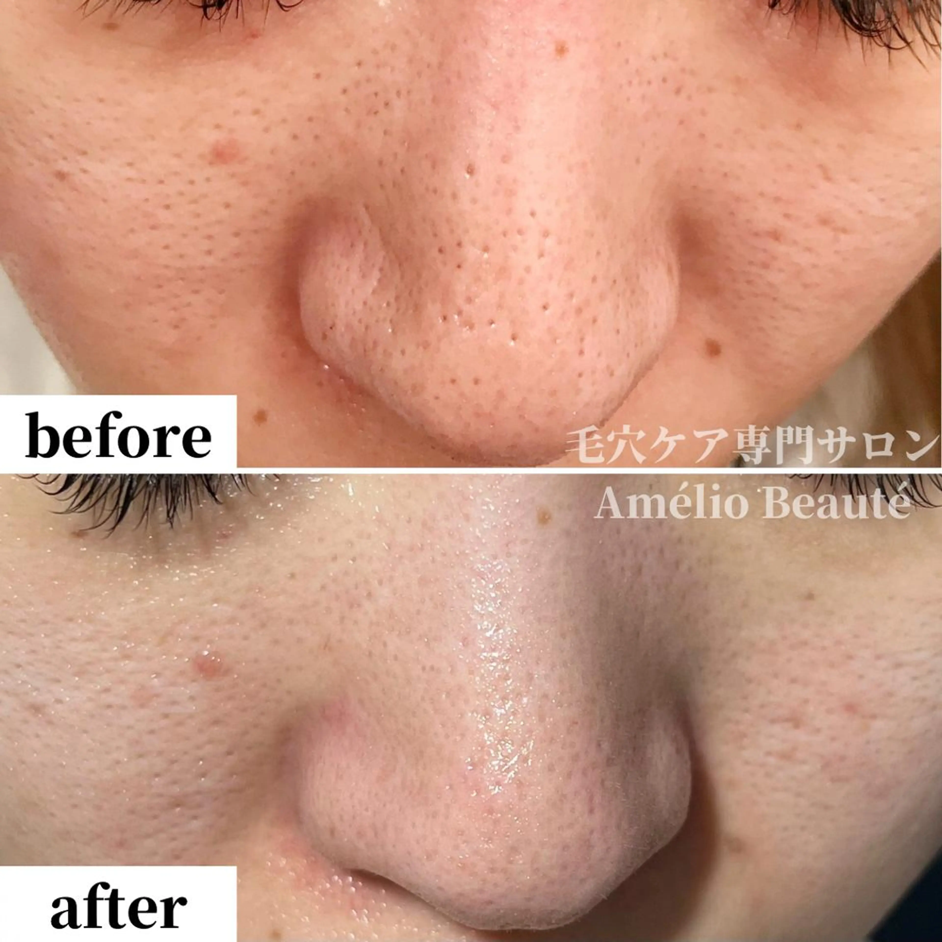 毛穴ケア専門サロン Amélio Beauté所属・毛穴ケア専門サロン アメリオボーテのその他イメージ