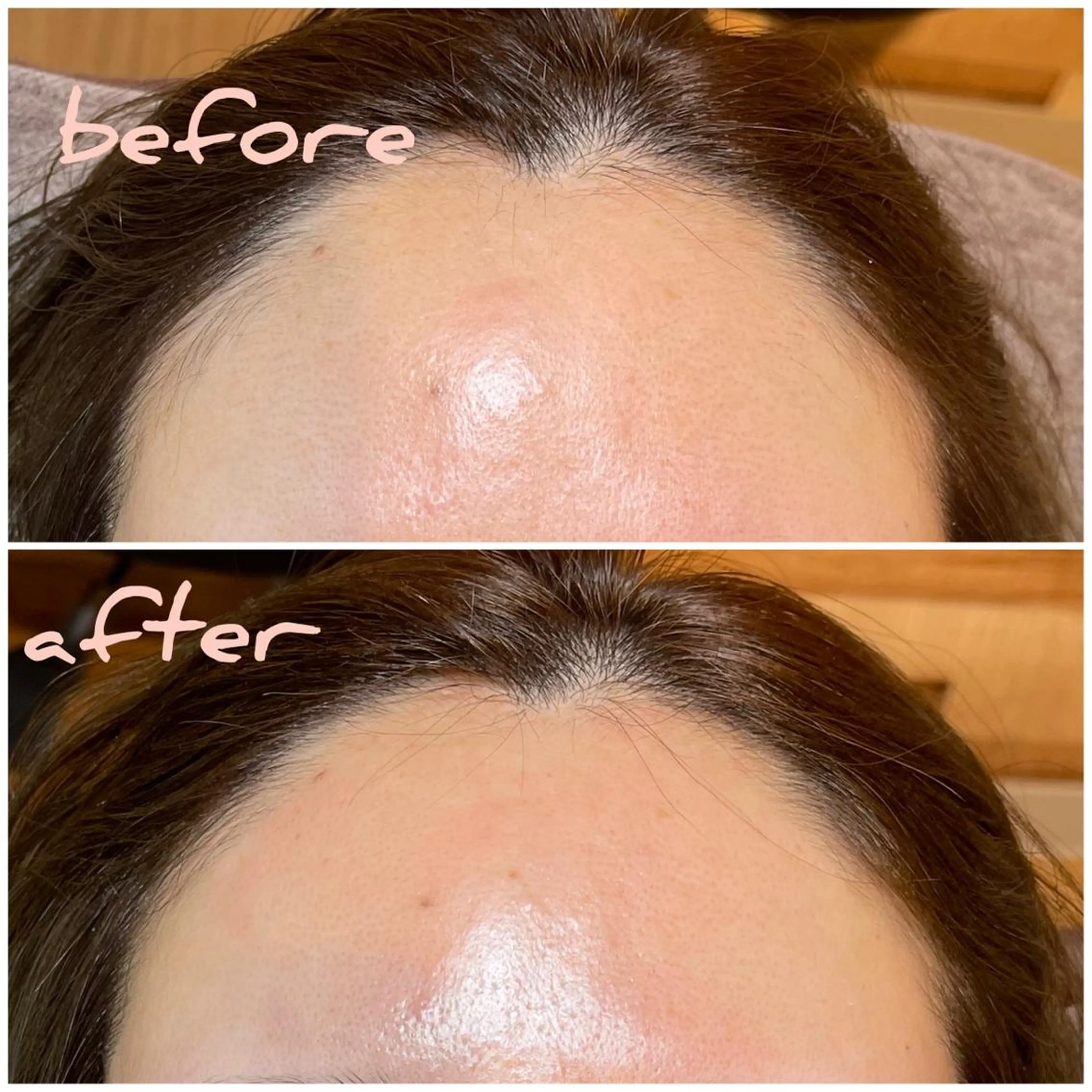 SNSで話題☆美眉&おでこwaxハイドロジェリーマスク付きの写真