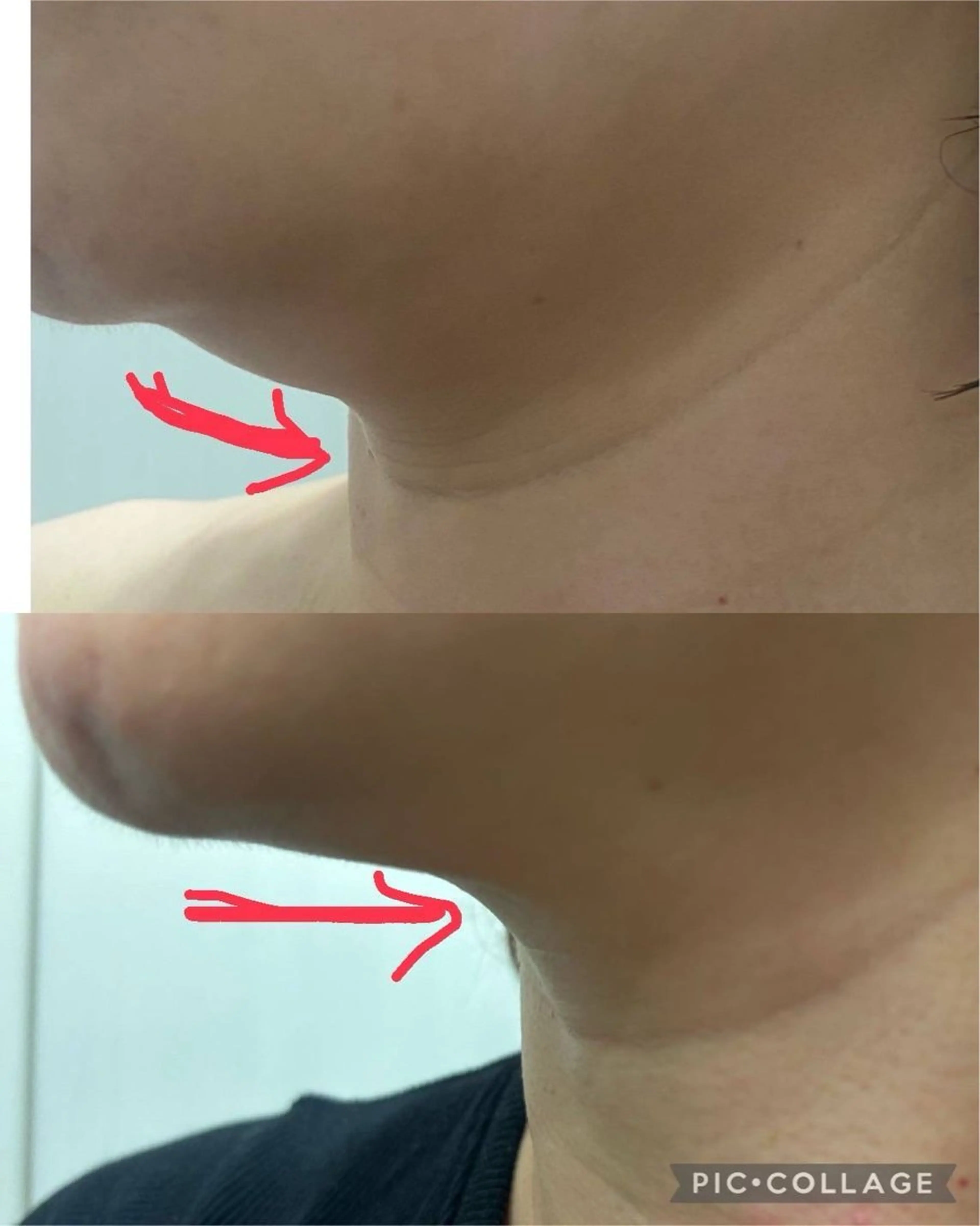 エステ ROR所属・ROR nailのエステ・リラクイメージ