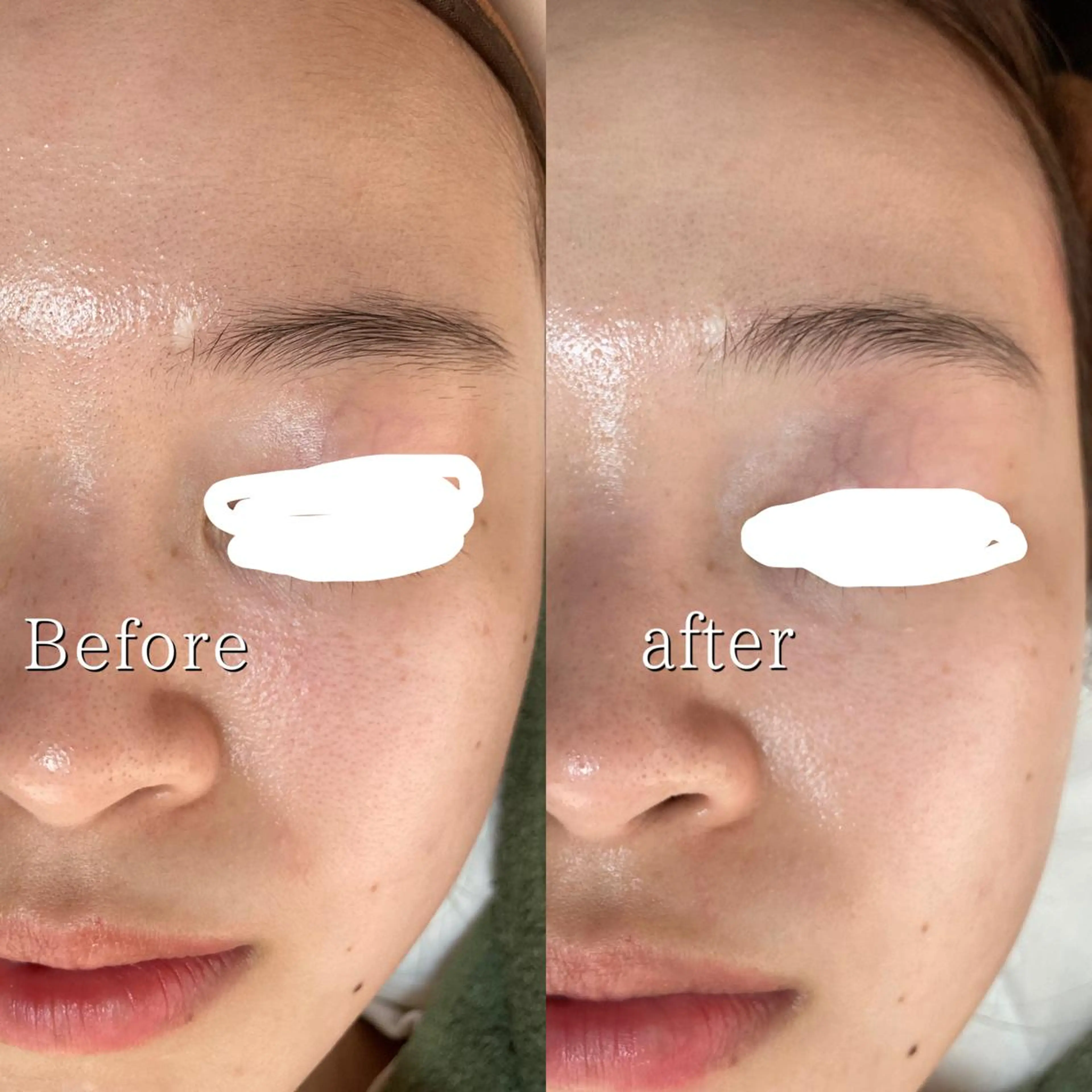 脱毛サロン KiWiのエステ・リラクイメージ