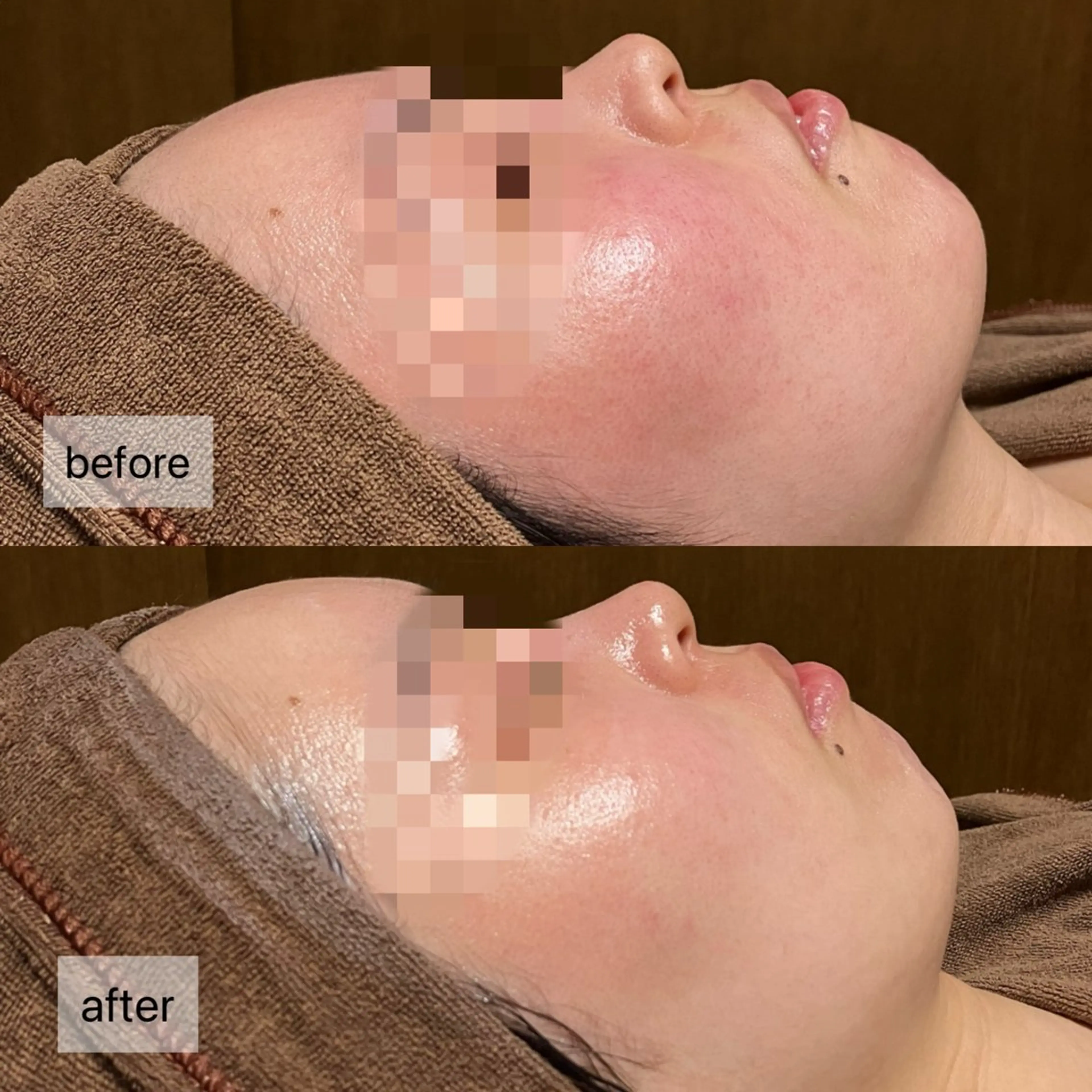 エステ HINANO矢場町店【ヒナノ】所属・脱毛/肌改善🌿 HINANO 村田のエステ・リラクイメージ