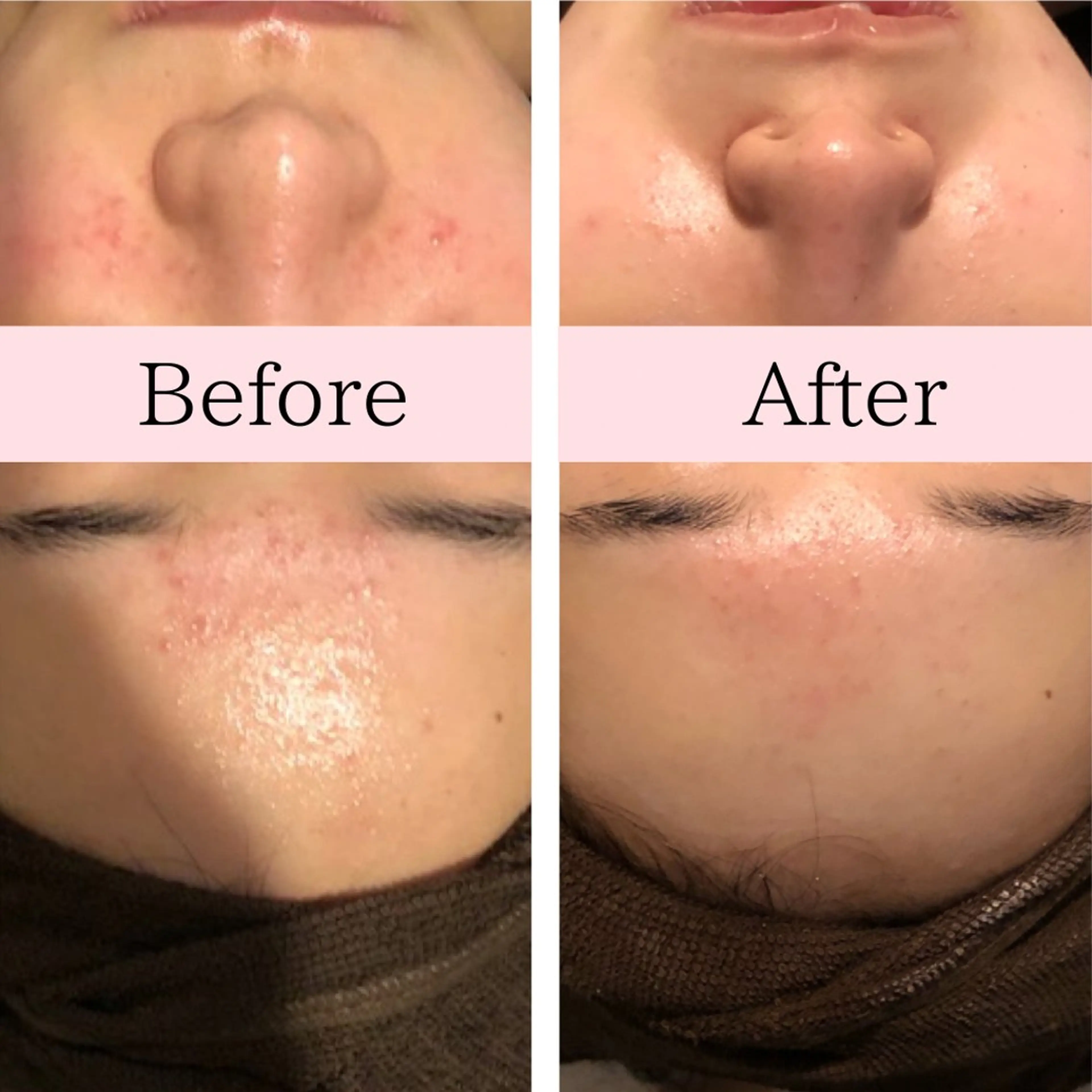 エステ 毛穴ニキビ専門 ビューティーグランツのエステ・リラクイメージ