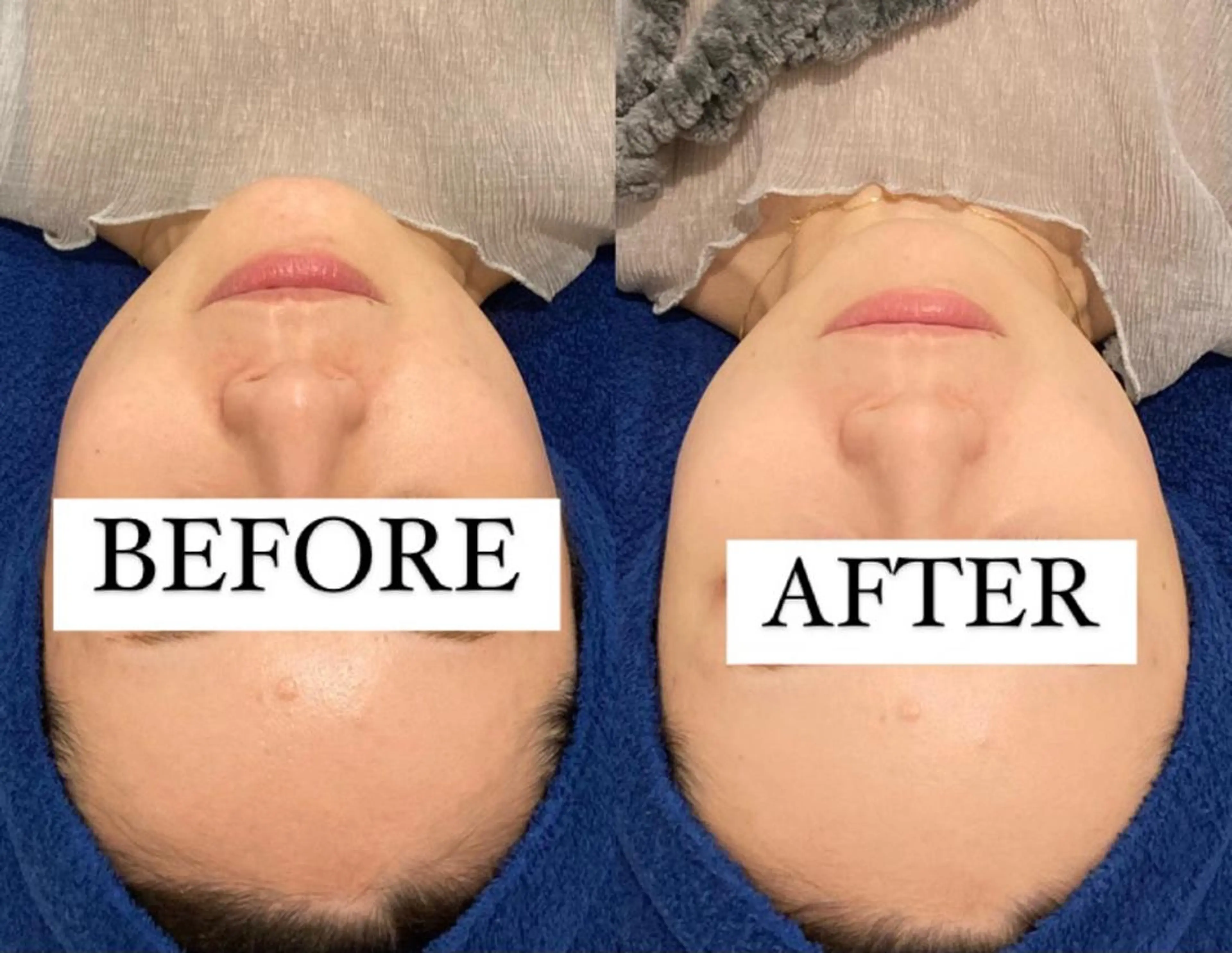 メンズ エステ リラク NANI OAFU所属・NANIOAFU [なんば店］のその他イメージ