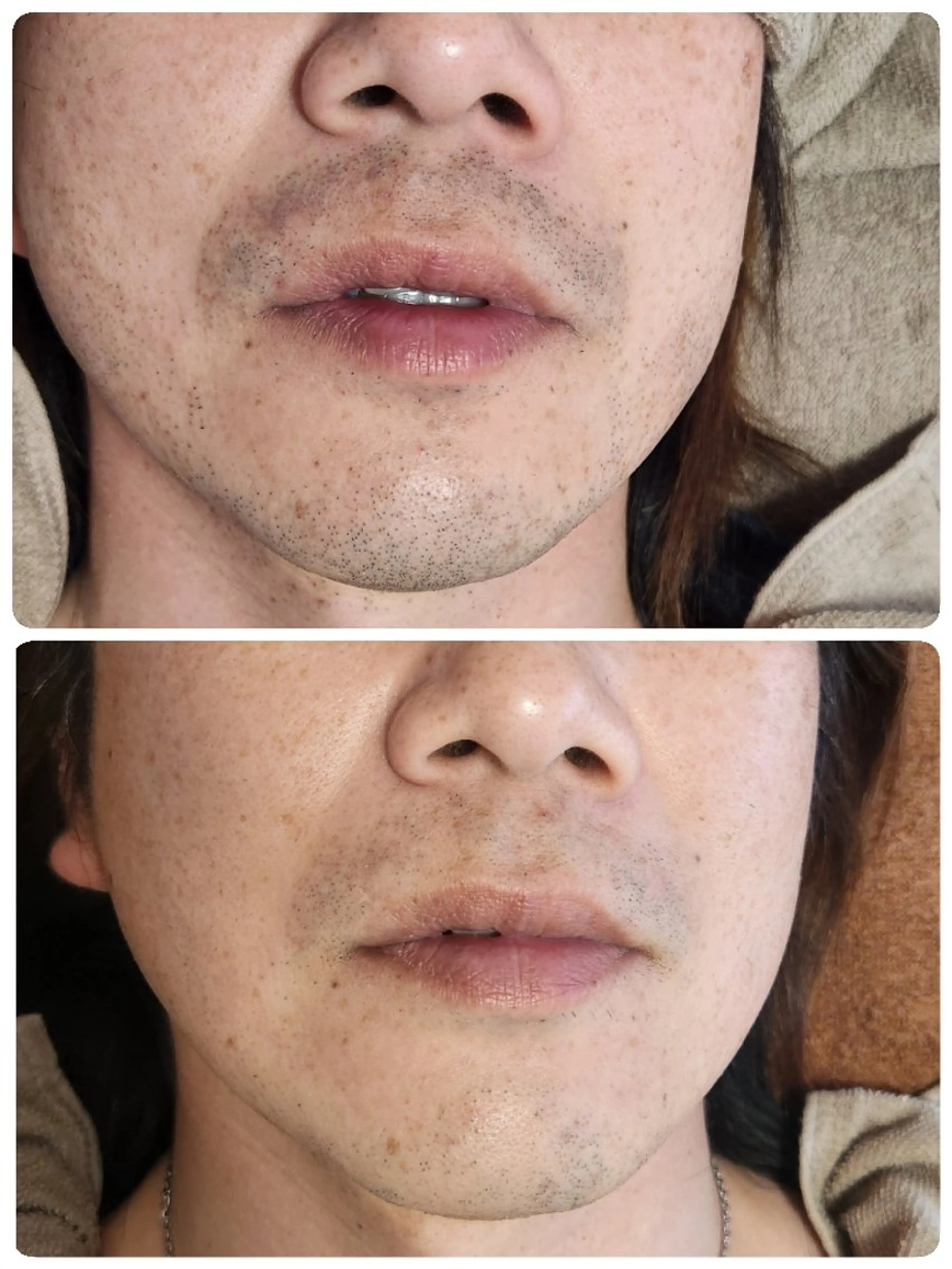 メンズ 脱毛 MERMAN マーマンのエステ・リラクイメージ