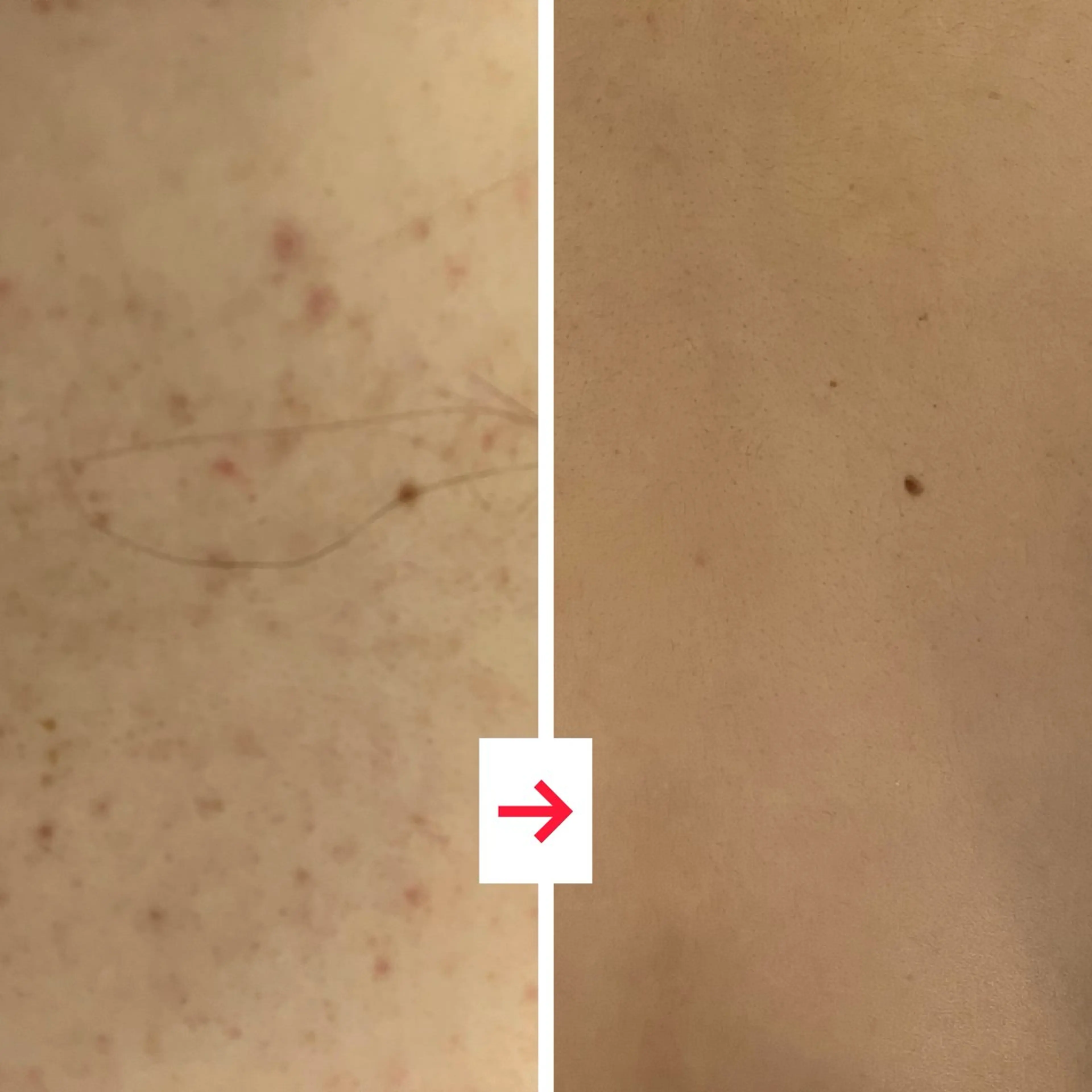 その他 たるみ改善小顔エステ 堀葉月のその他イメージ