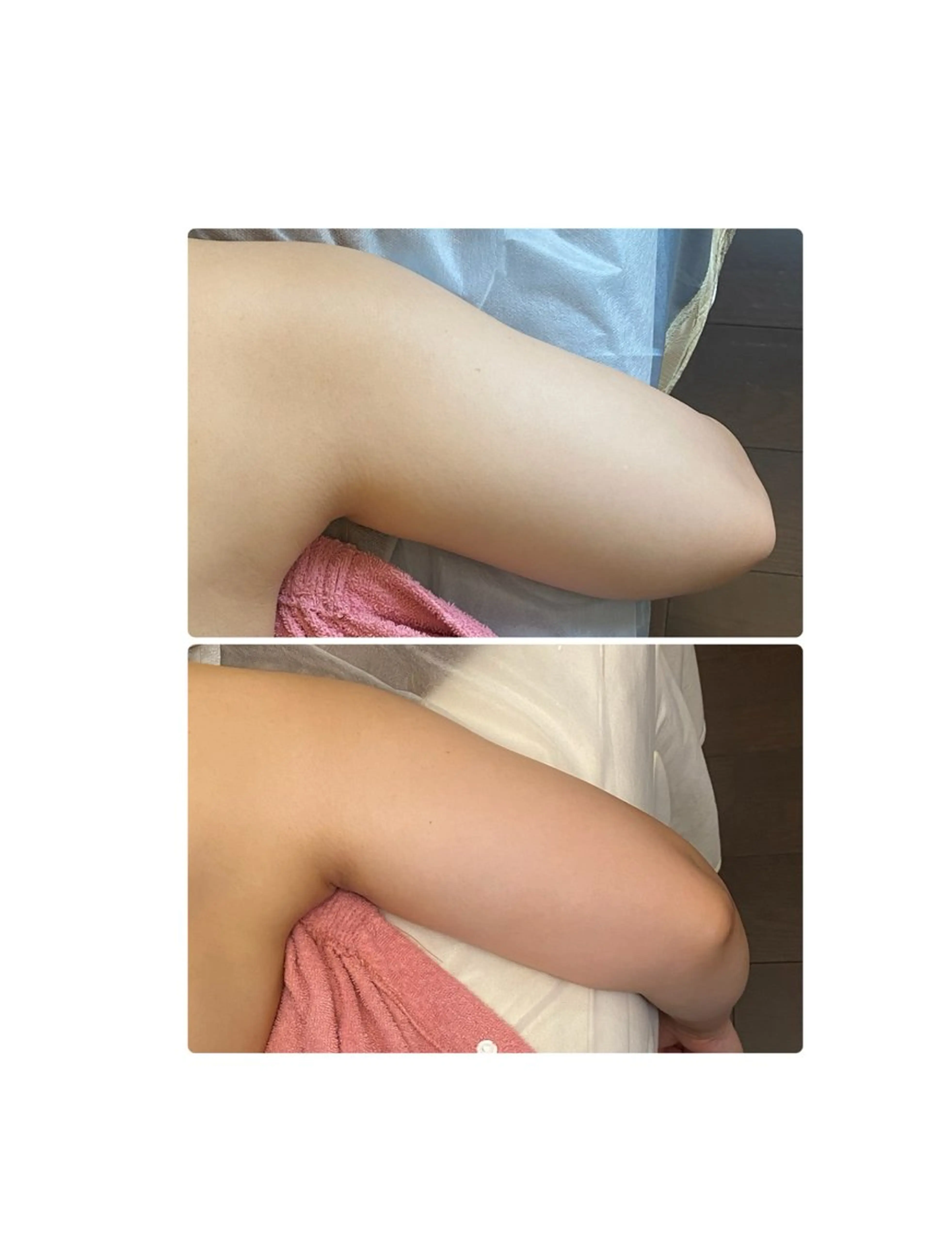 エステ リラク 脱毛・エステサロン LuLuNのエステ・リラクイメージ