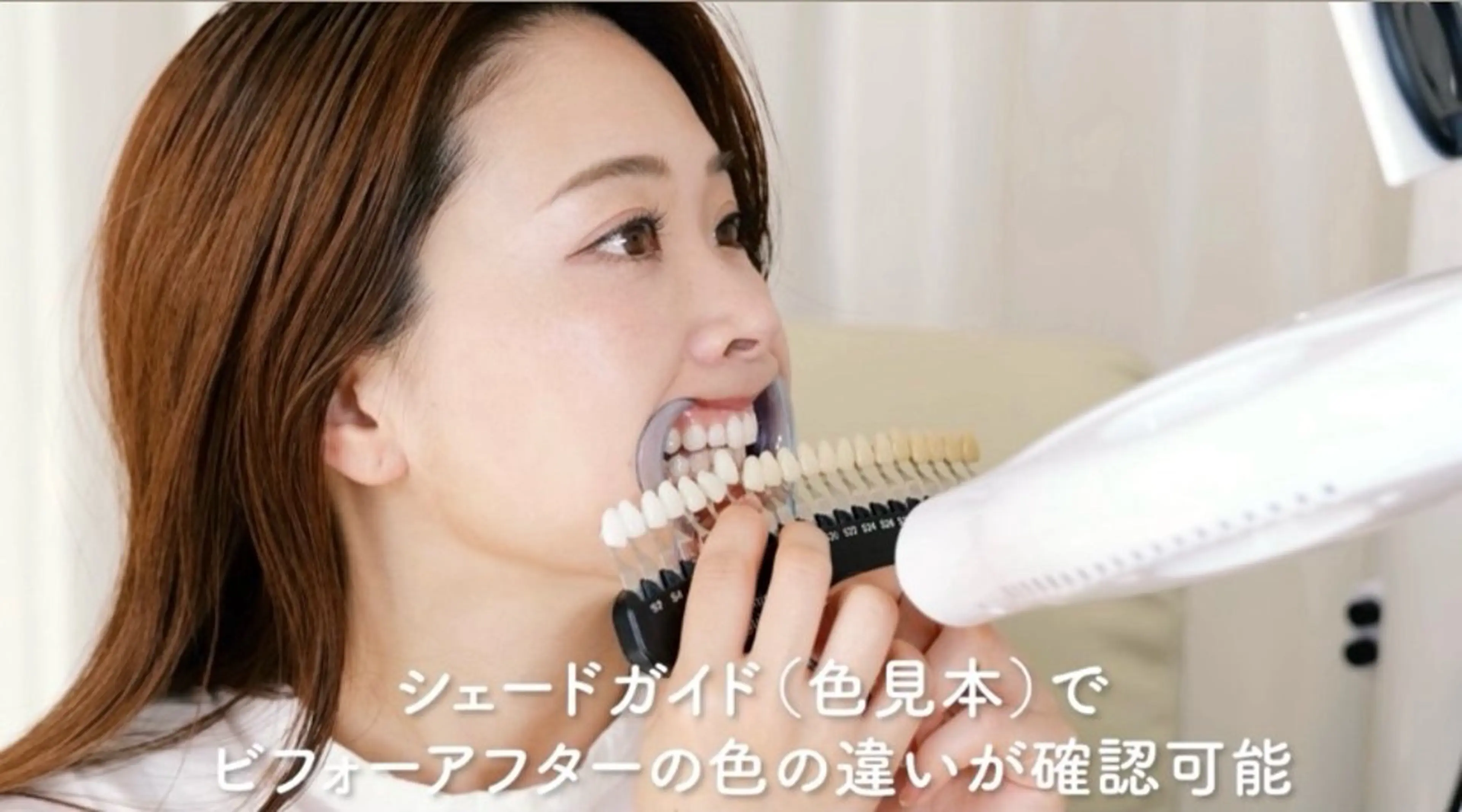 その他 セルフホワイトニング サクッとホワイト   立川店所属・サクッとホワイト 立川店のその他イメージ