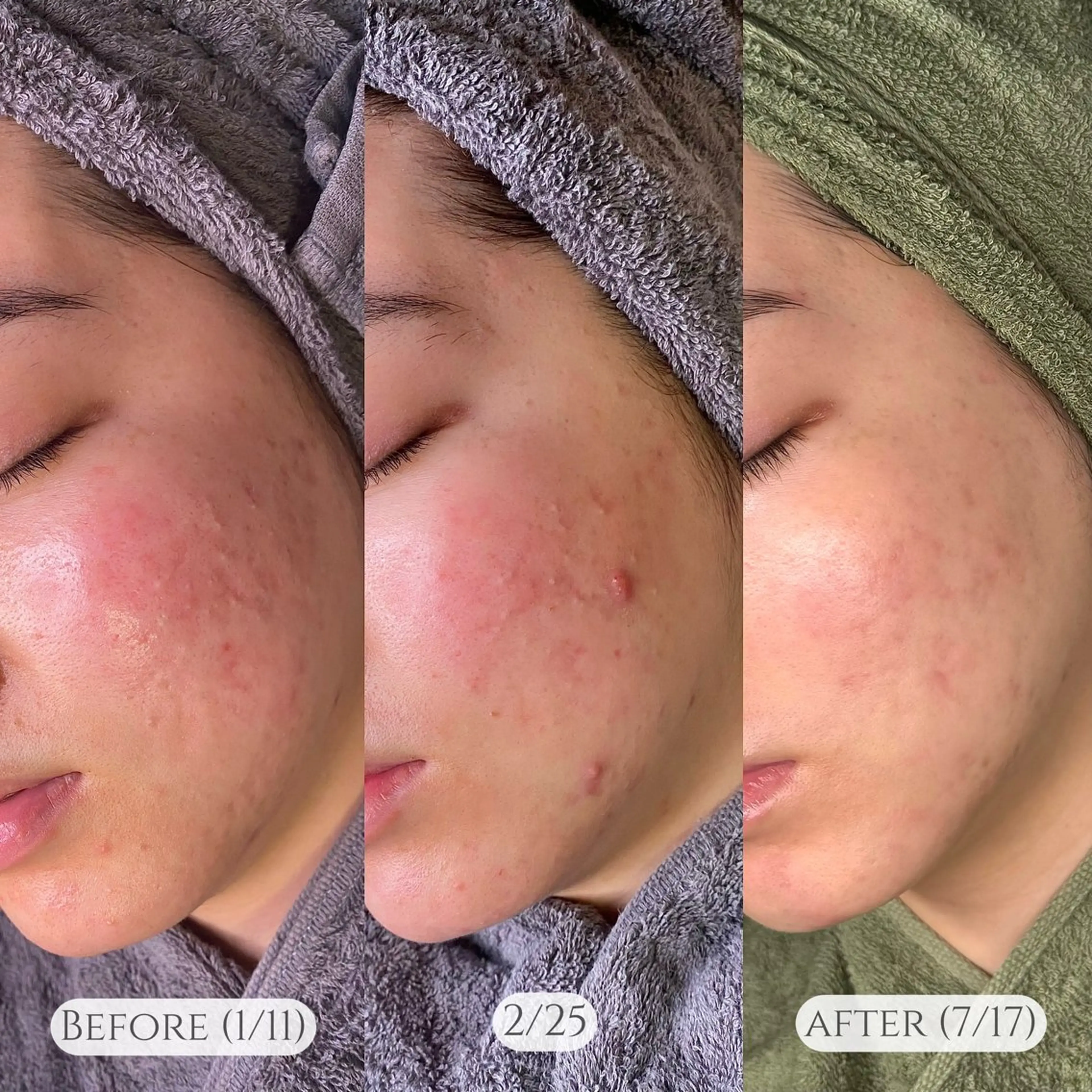 Mau beauty salon所属・Mau (マウ)のエステ・リラクイメージ