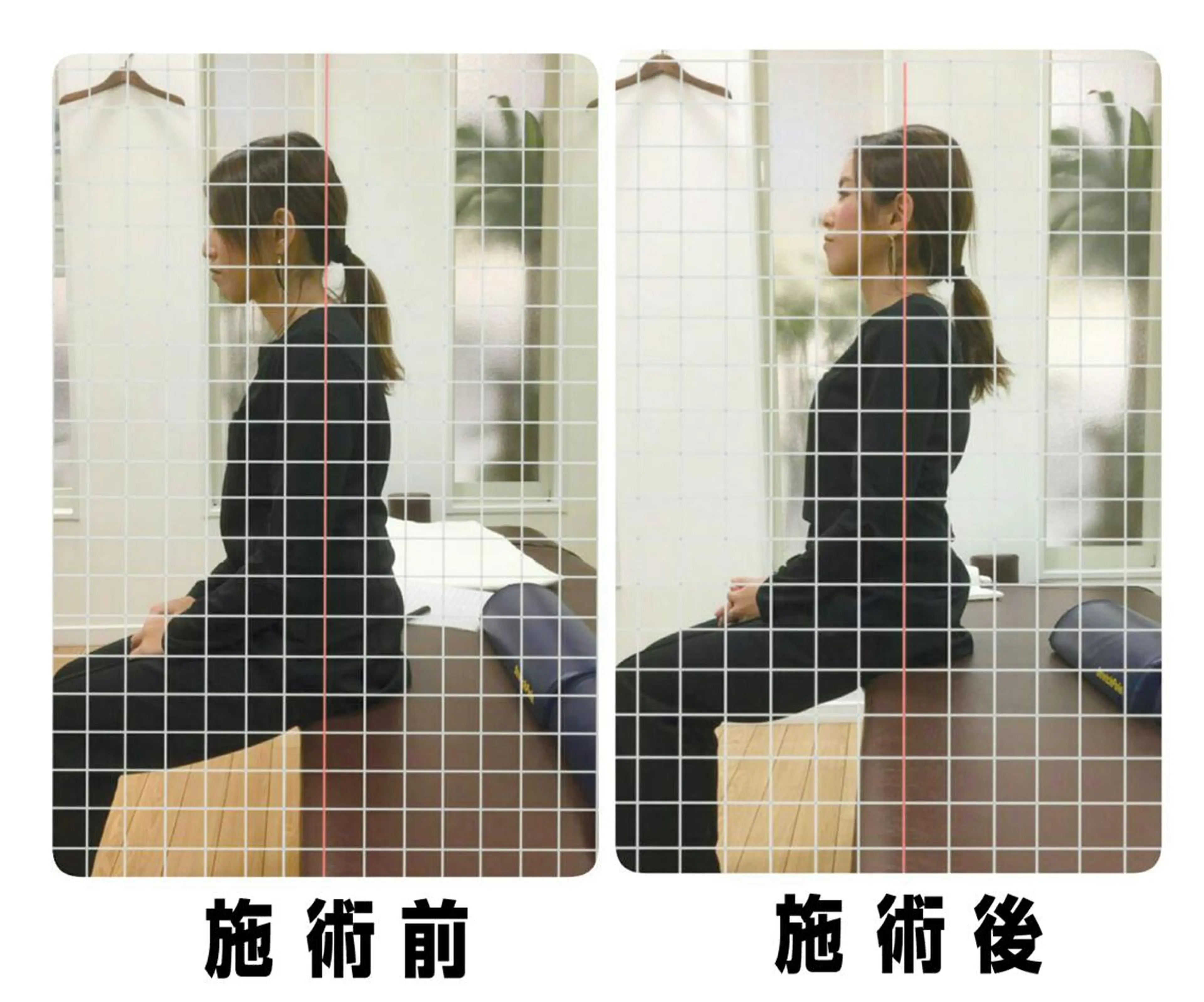 猫背矯正の写真