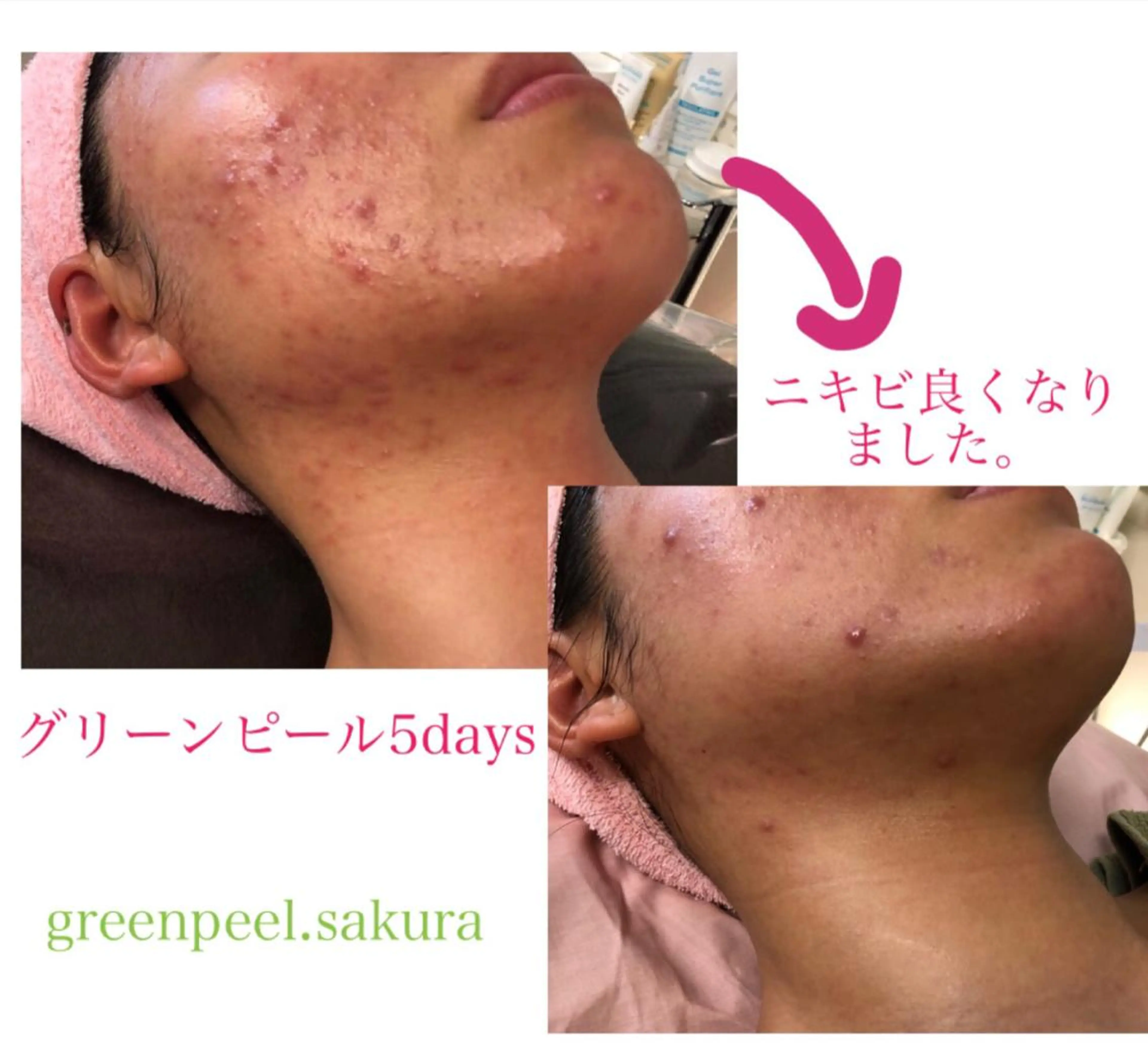 鈴木 さくらのエステ・リラクイメージ