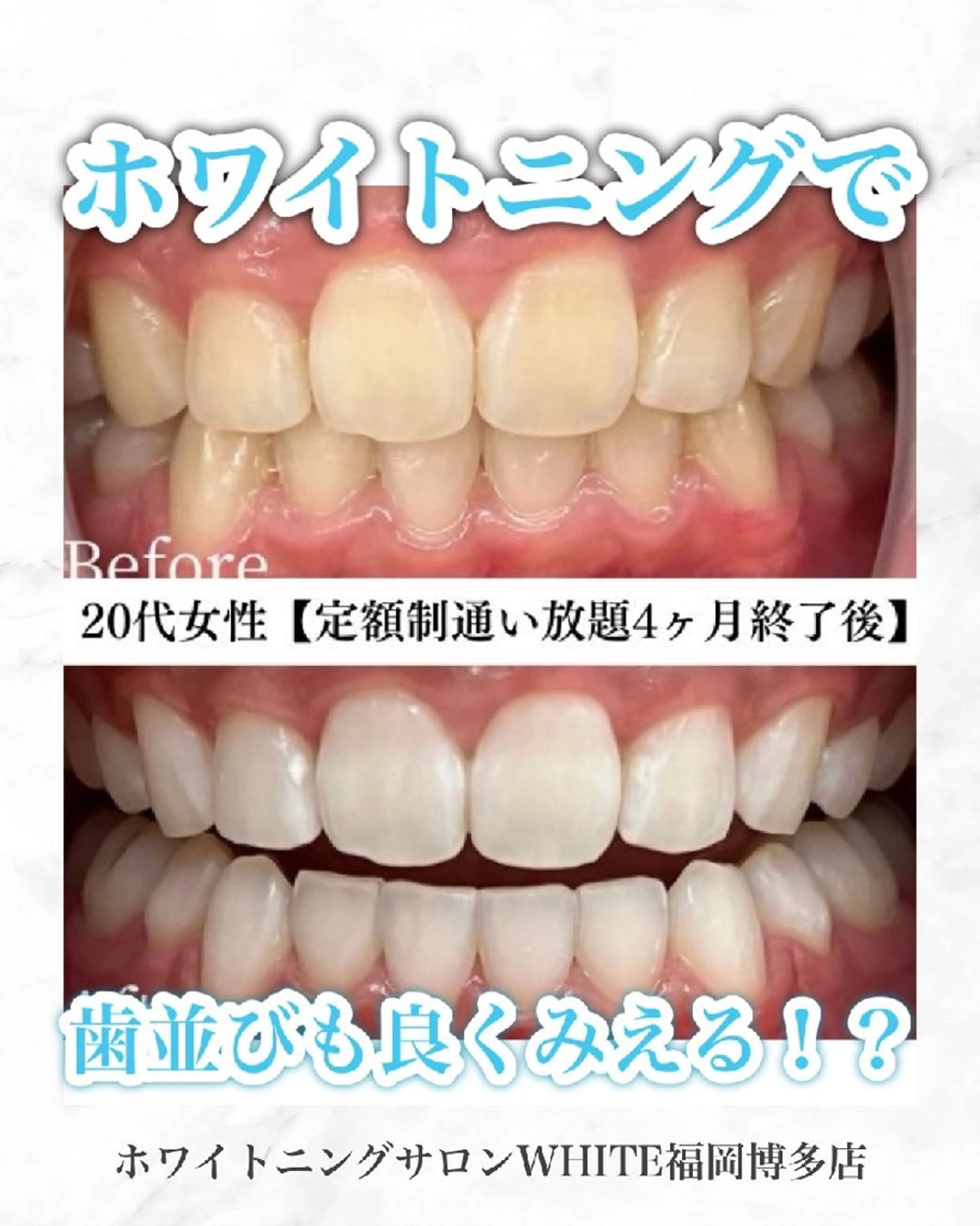 キッズ メンズ エステ リラク ホワイトニングサロン WHITE福岡博多店のエステ・リラクイメージ