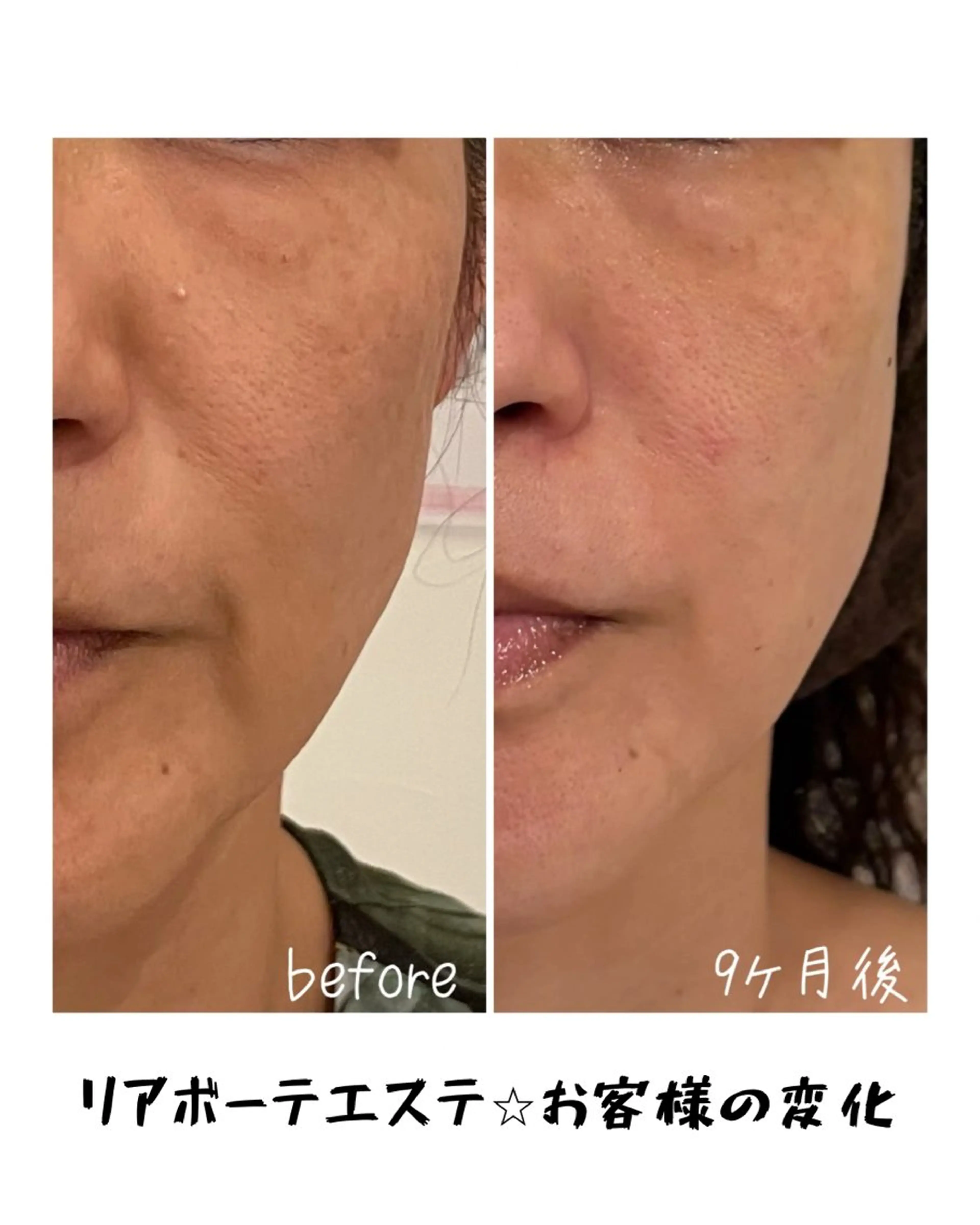 エステ 浜野 恵美のエステ・リラクイメージ