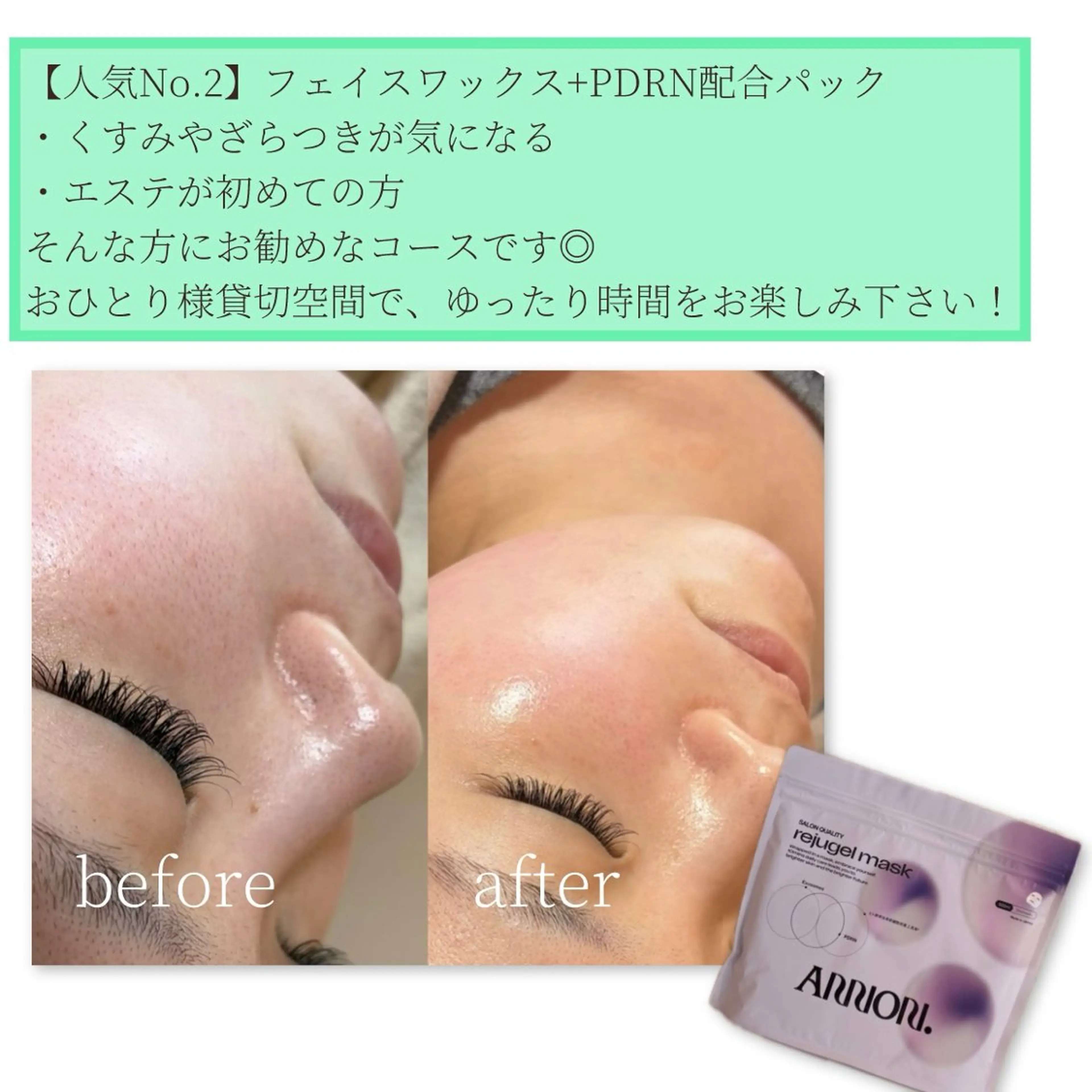 その他 Erika komorebi_のエステ・リラクイメージ