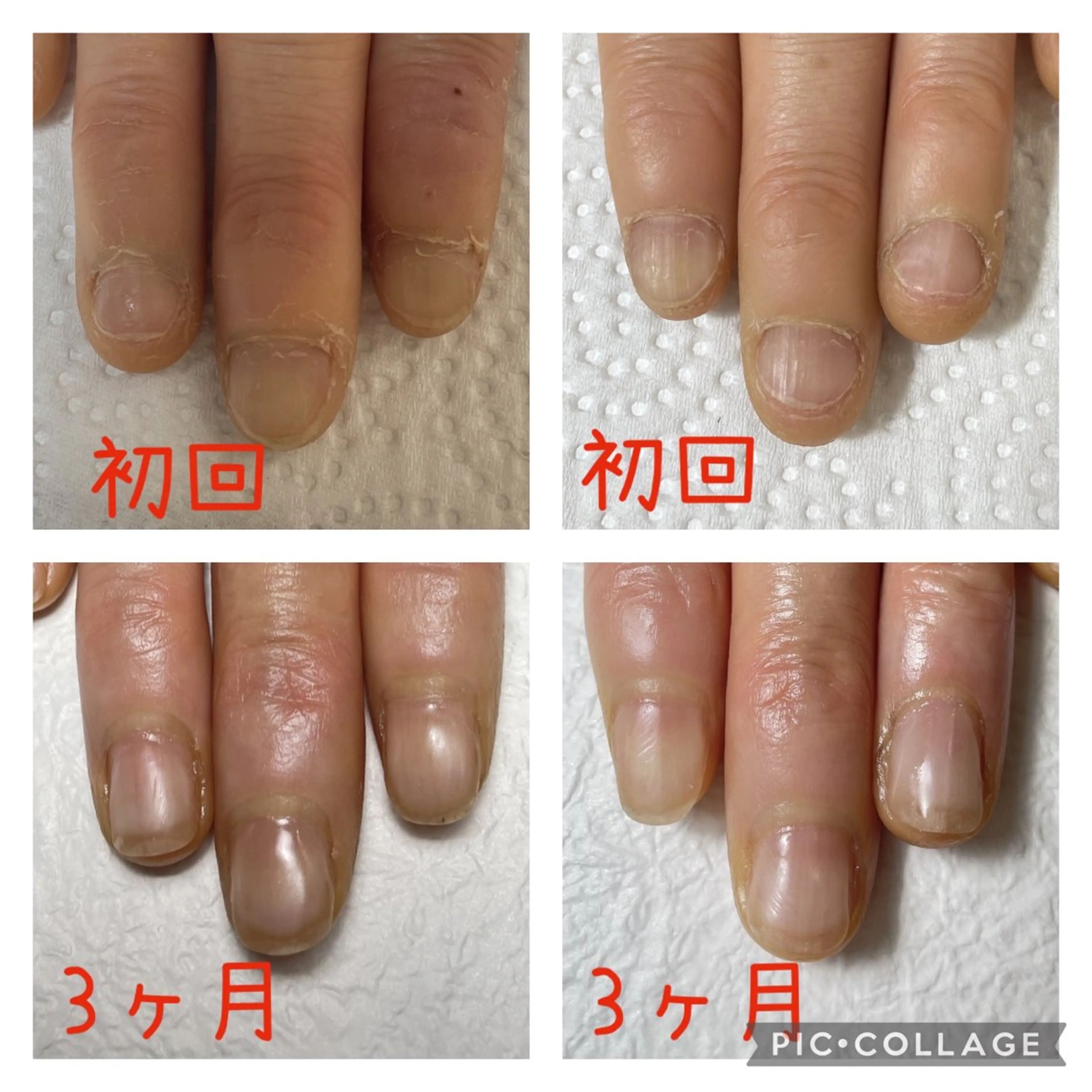 ネイル 荒井 恵のネイルデザイン