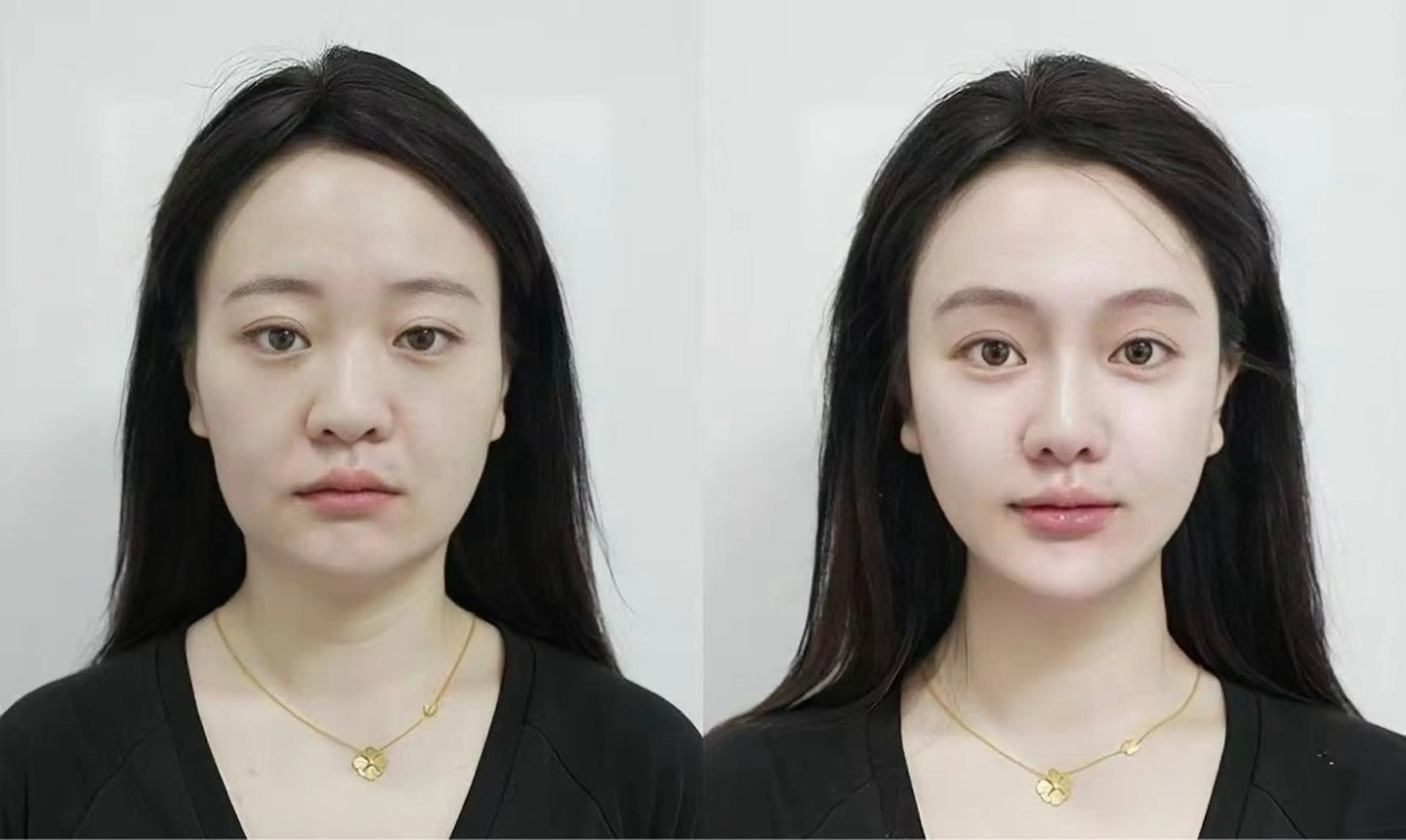 マツエク・マツパ エステ リラク 愛維美水光美肌専門店所属・愛維美水光美肌専門店 メンズレディースokのエステ・リラクイメージ