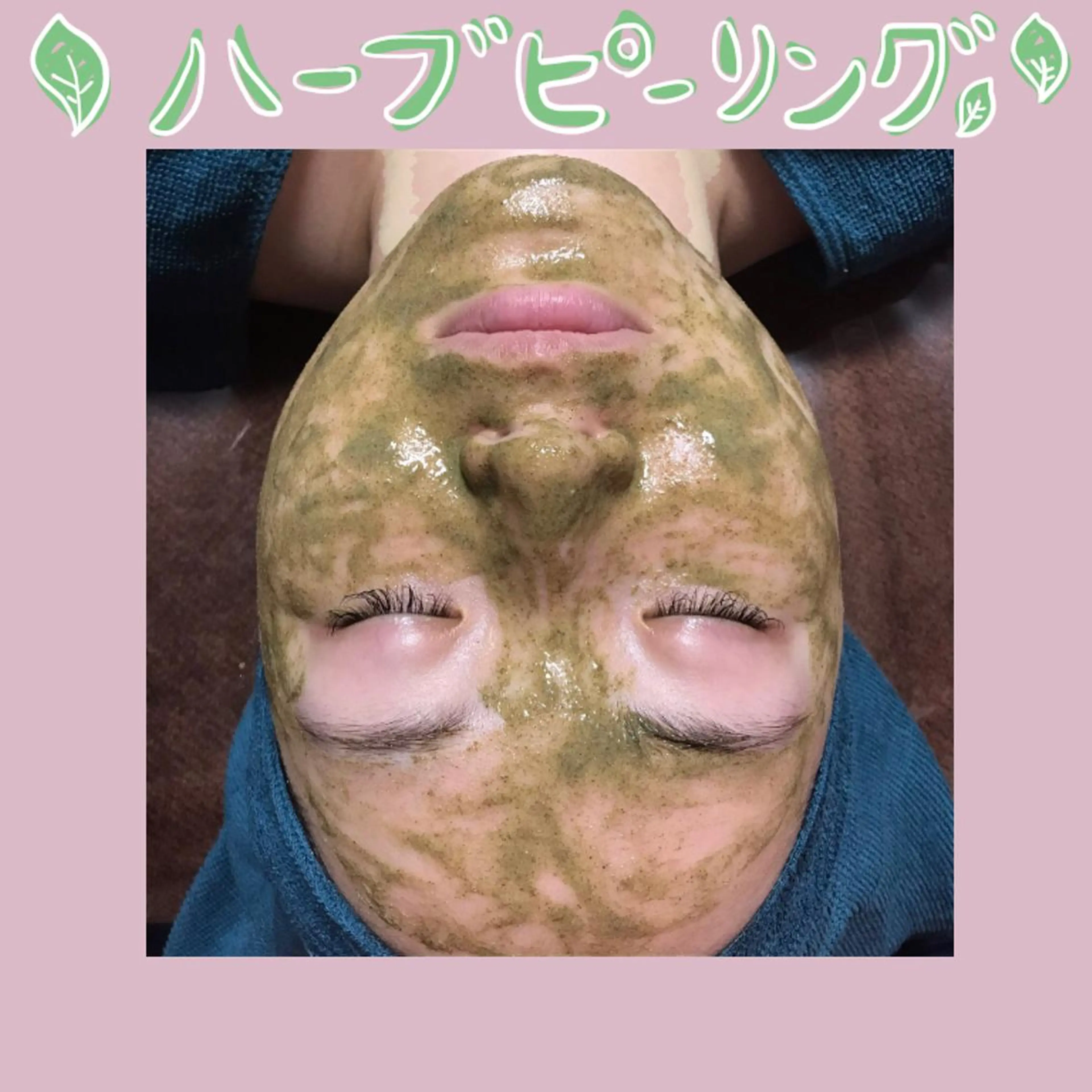 【minimo限定！毛穴の黒ずみ・ニキビ・くすみにオススメ¥15,000→¥10,000】陶器肌ハーブピーリングの写真