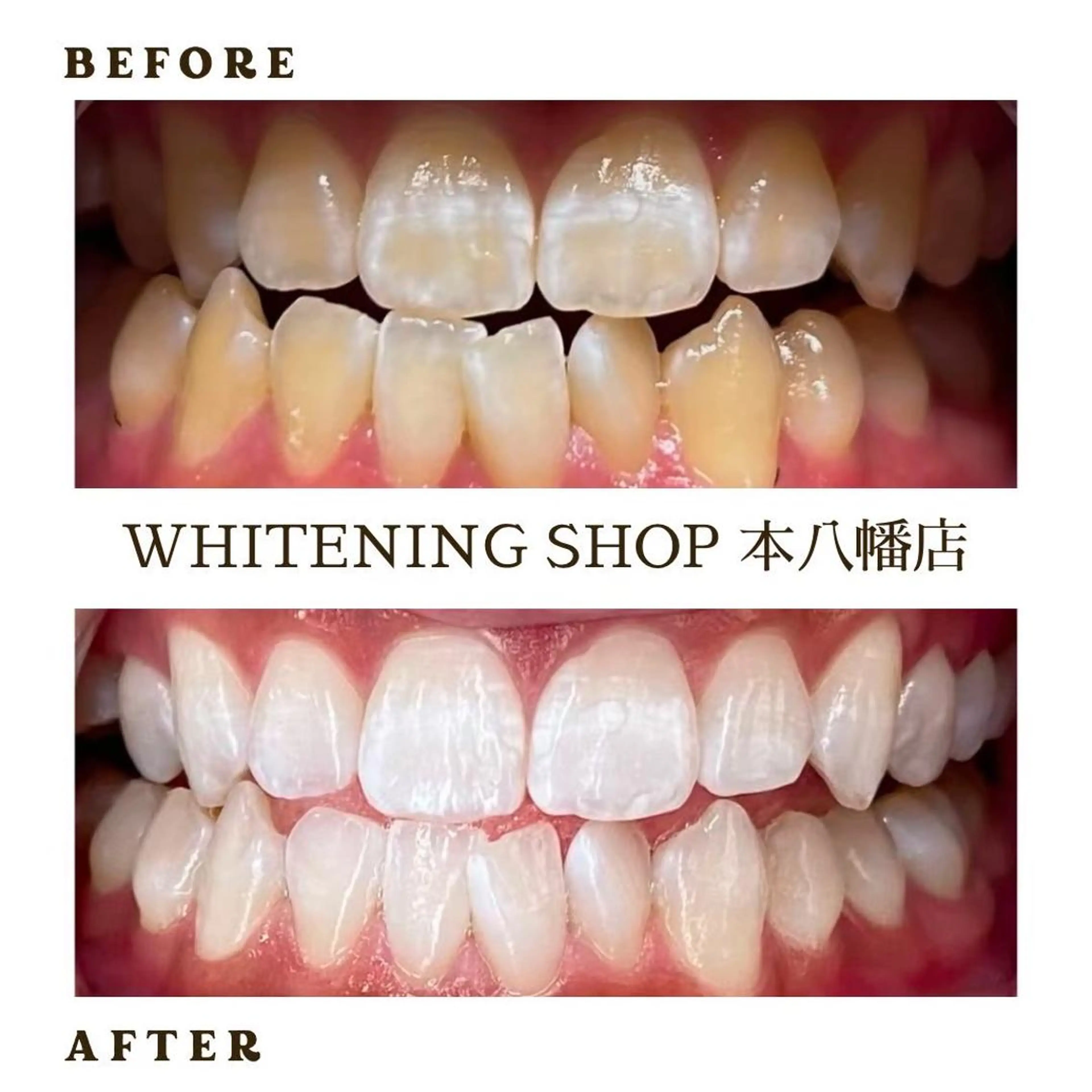 メンズ その他 ホワイトニング ショップ本厚木のその他イメージ