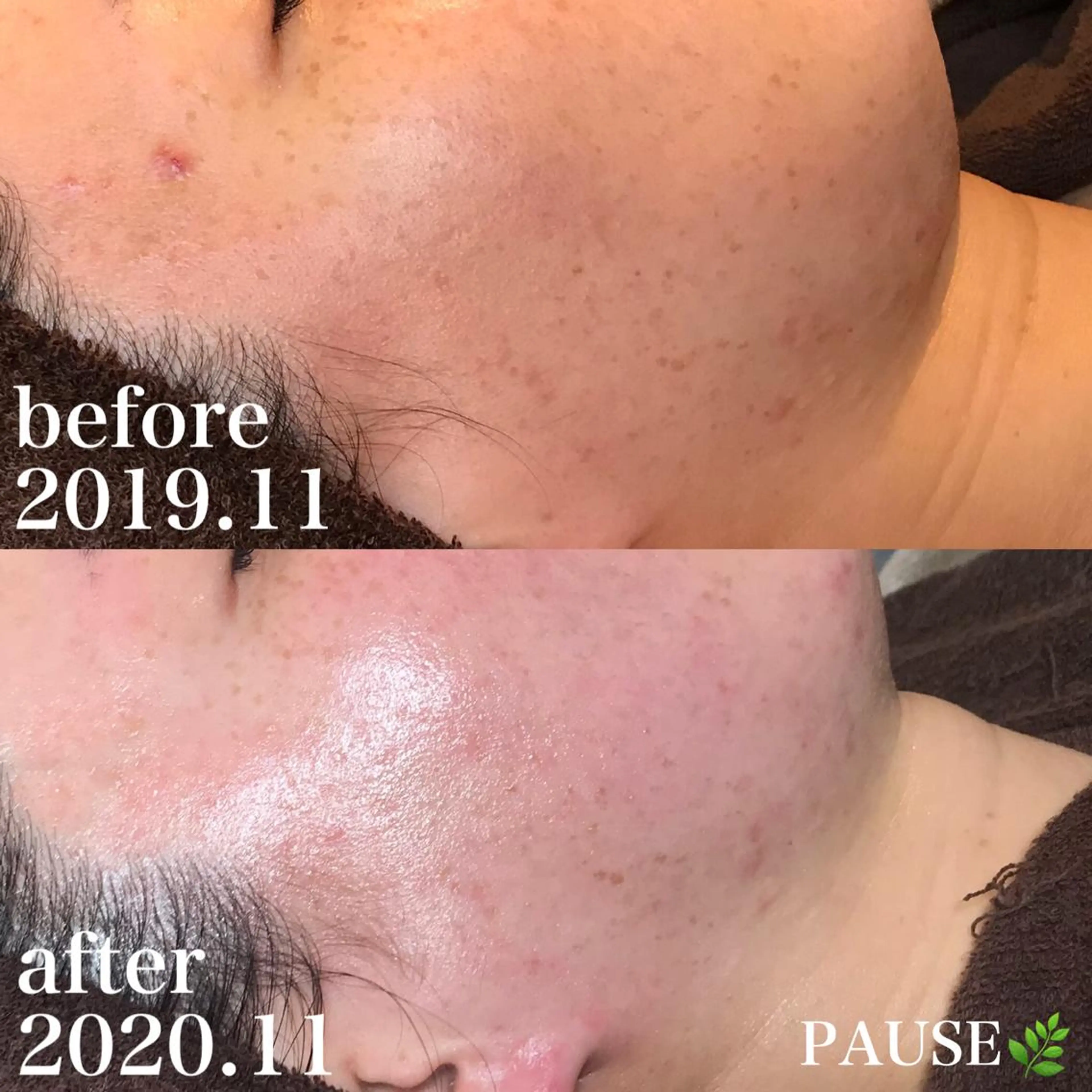 エステ 浜野 恵美のエステ・リラクイメージ