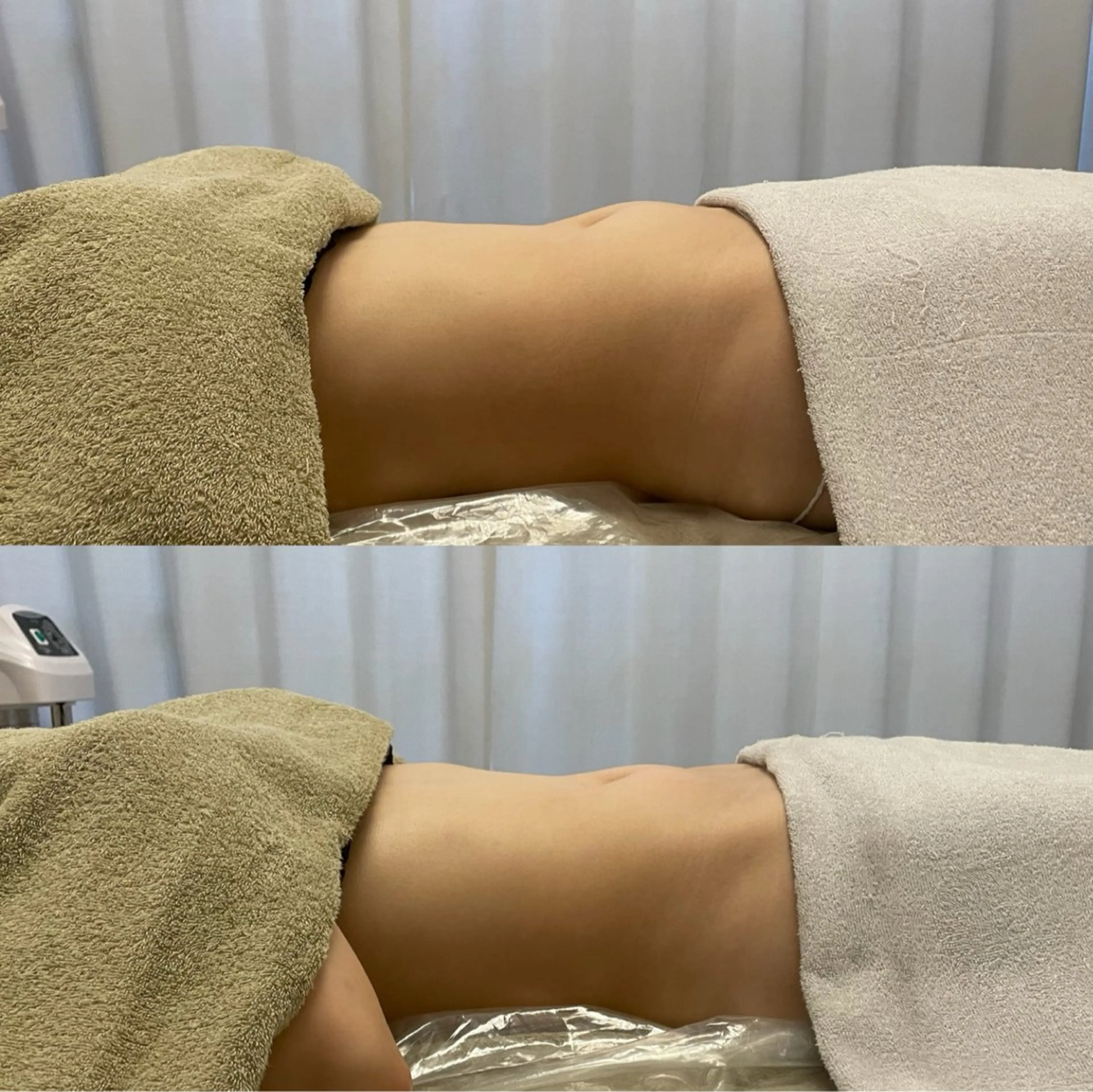 腸もみ・メンズ脱毛・ 毛穴洗浄〜カナロア〜のエステ・リラクイメージ