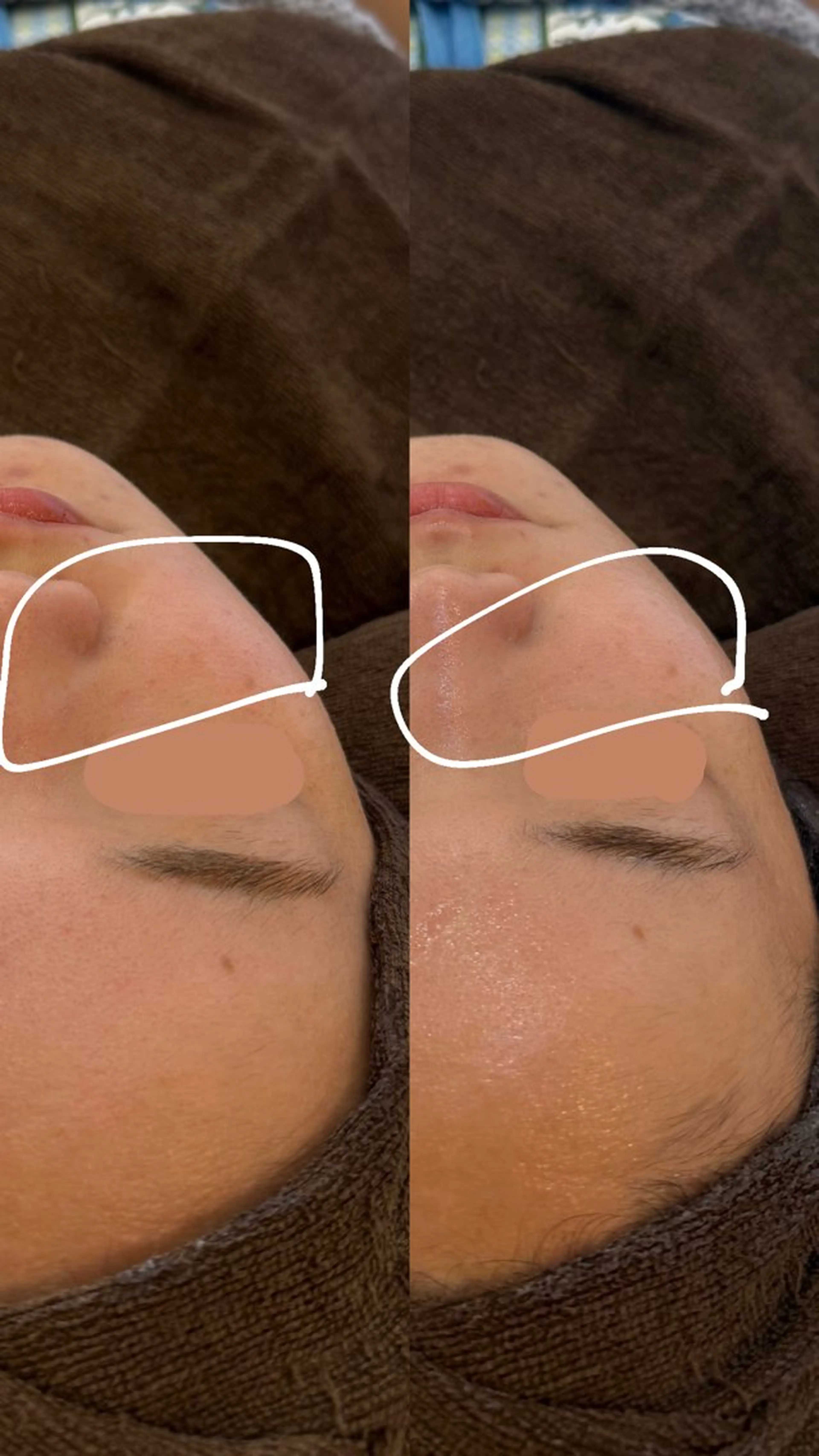 エステ yukiko/美容師 髪質改善×肌質改善のエステ・リラクイメージ