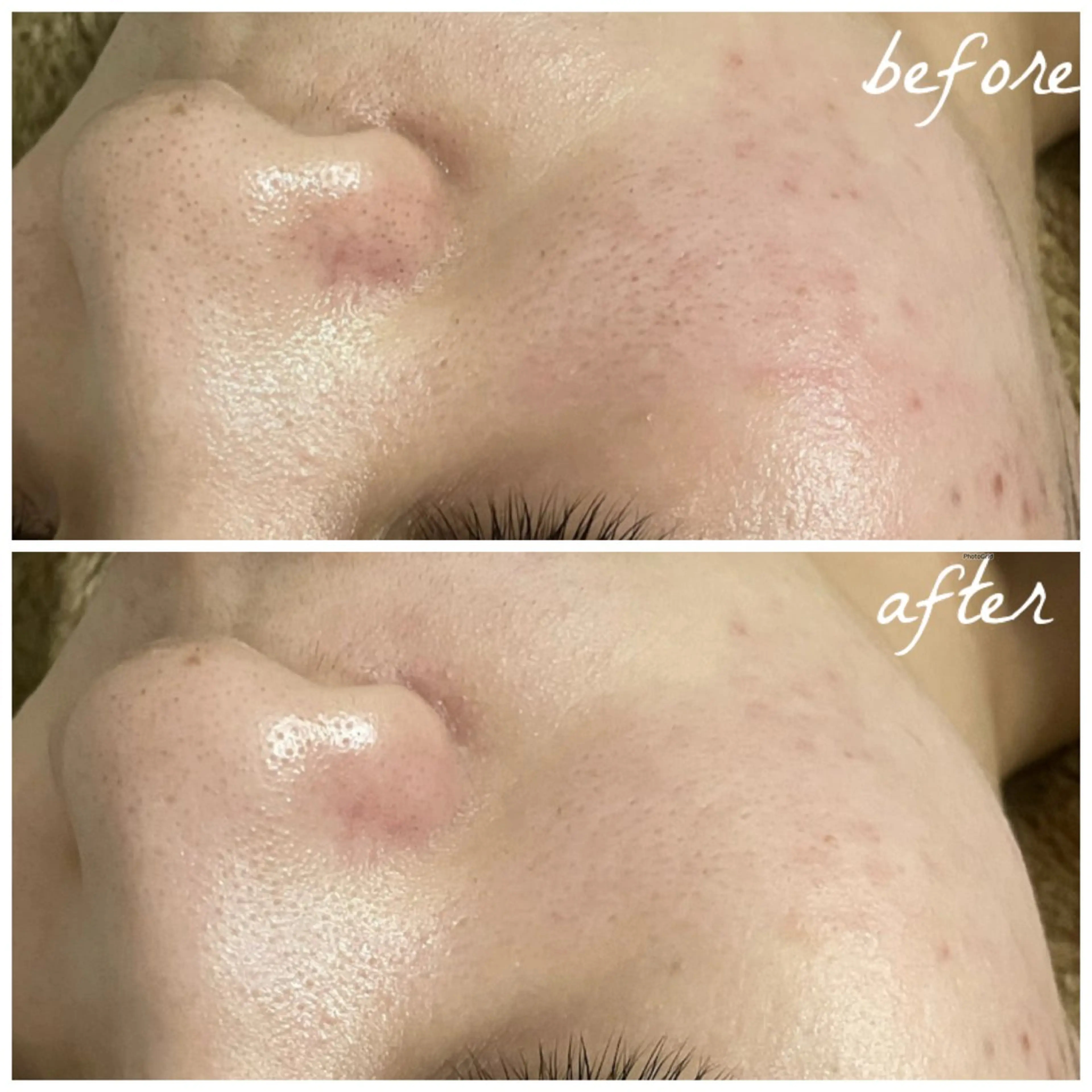 メンズ エステ メナード岐阜市茜部 杉浦のエステ・リラクイメージ